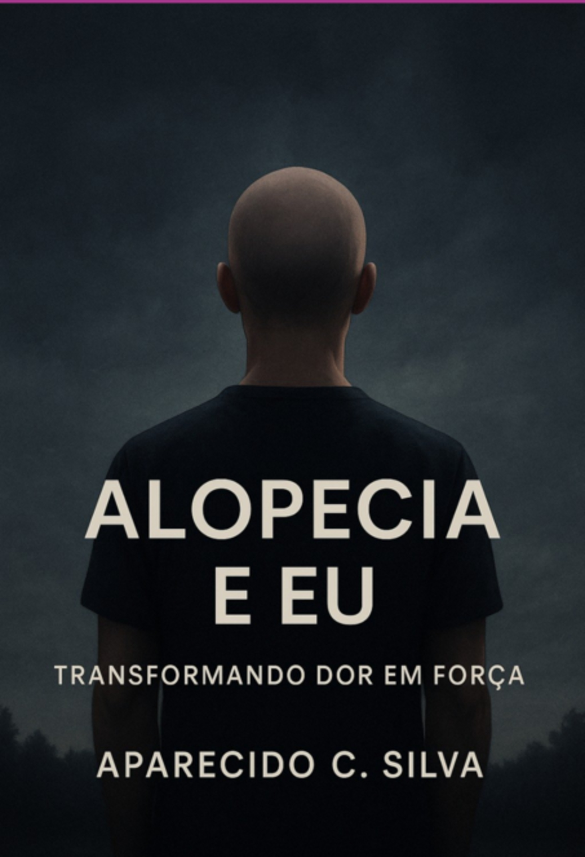 Alopécia E Eu