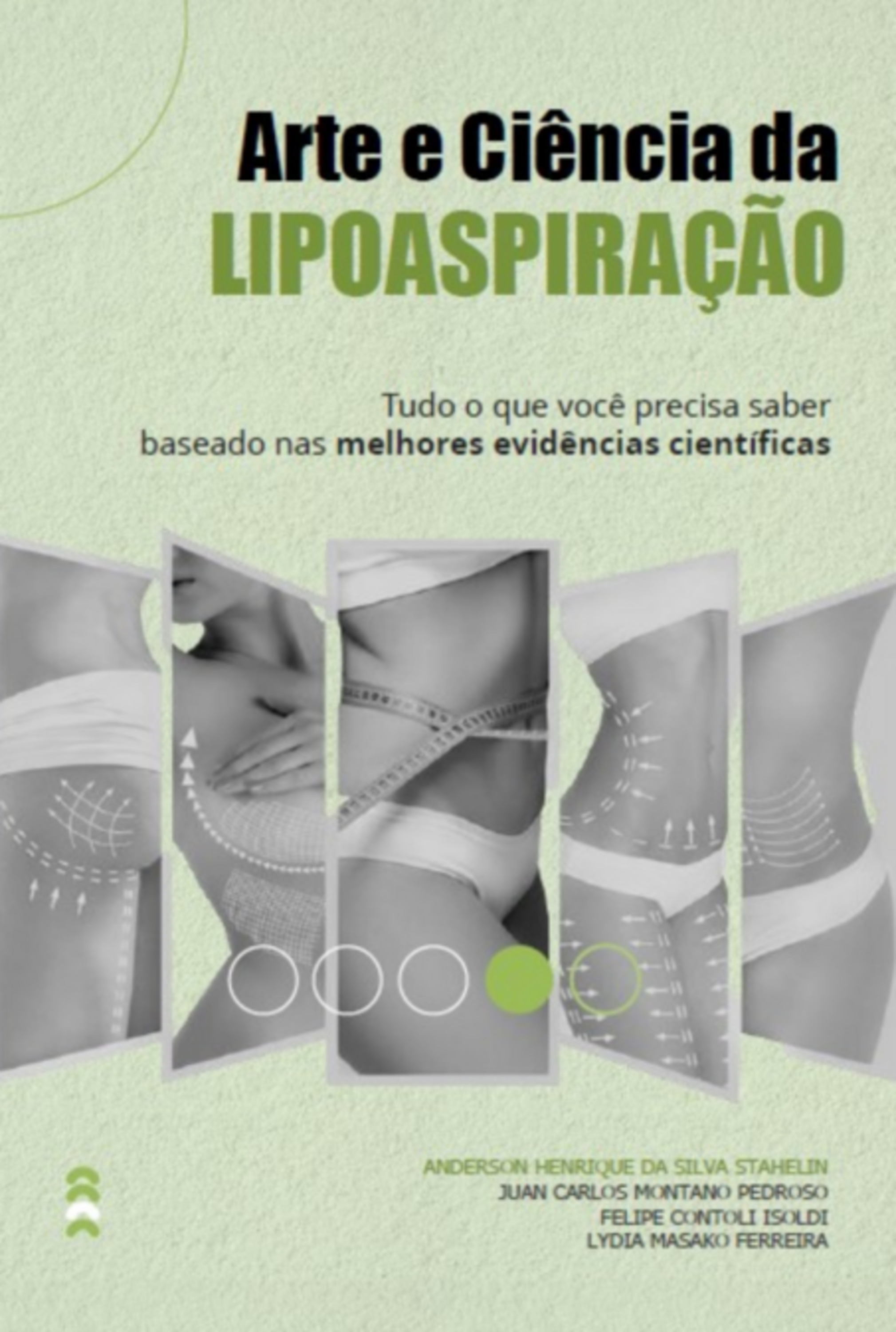 Arte E Ciência Da Lipoaspiração