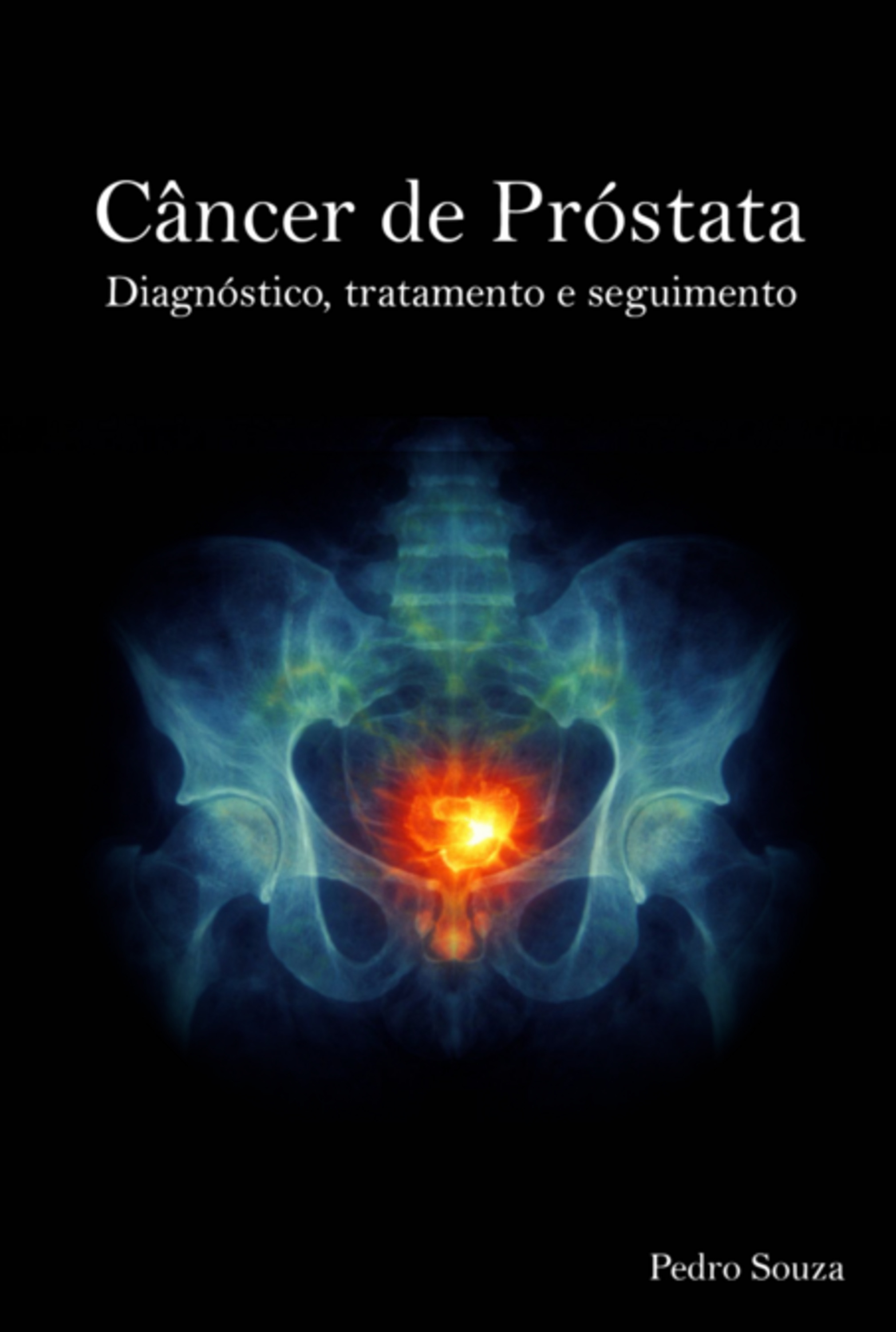 Câncer De Próstata