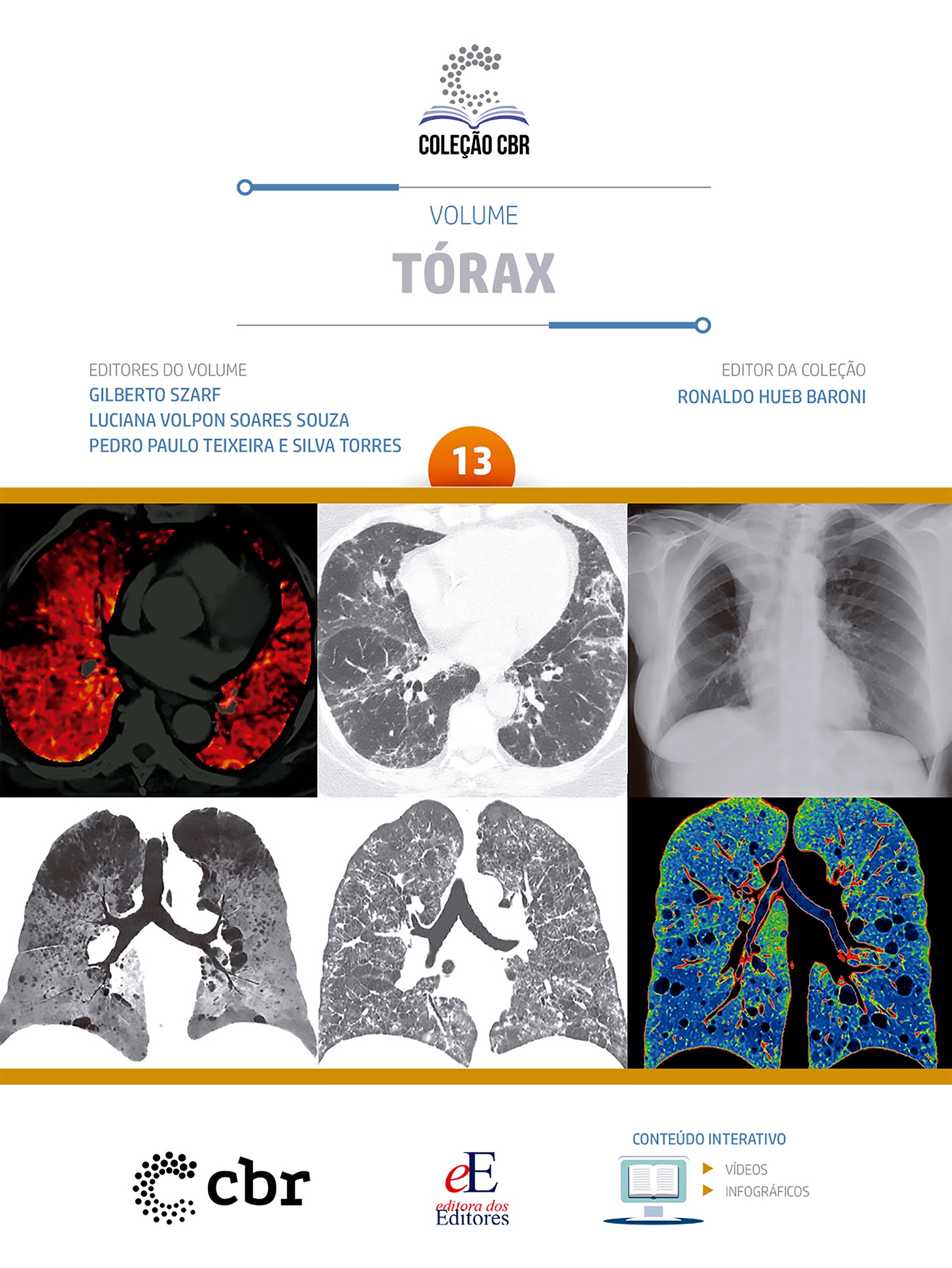 Coleção CBR Volume 13 - Tórax