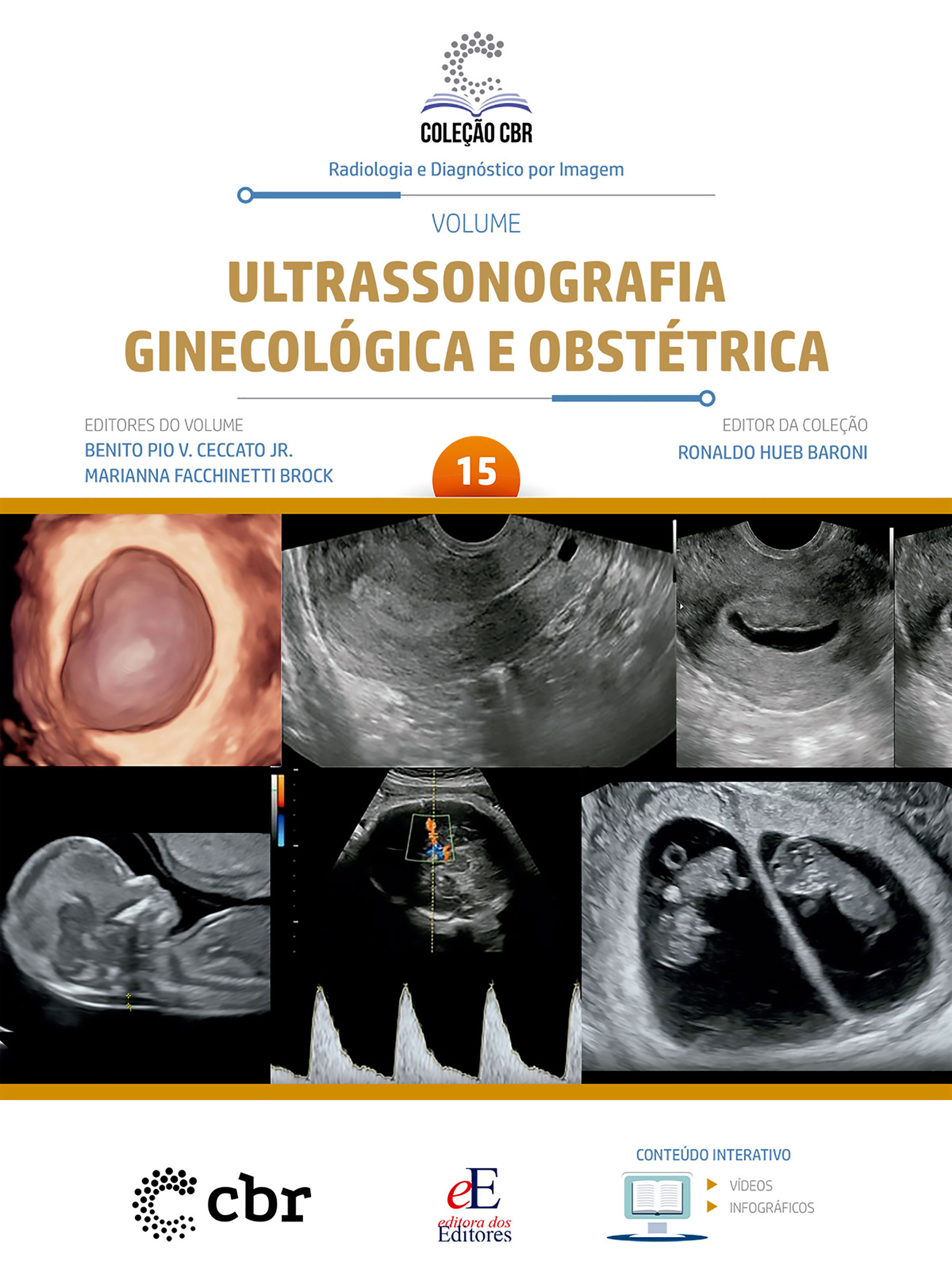 Coleção CBR Volume 15 - Ultrassonografia Ginecológica e Obstétrica