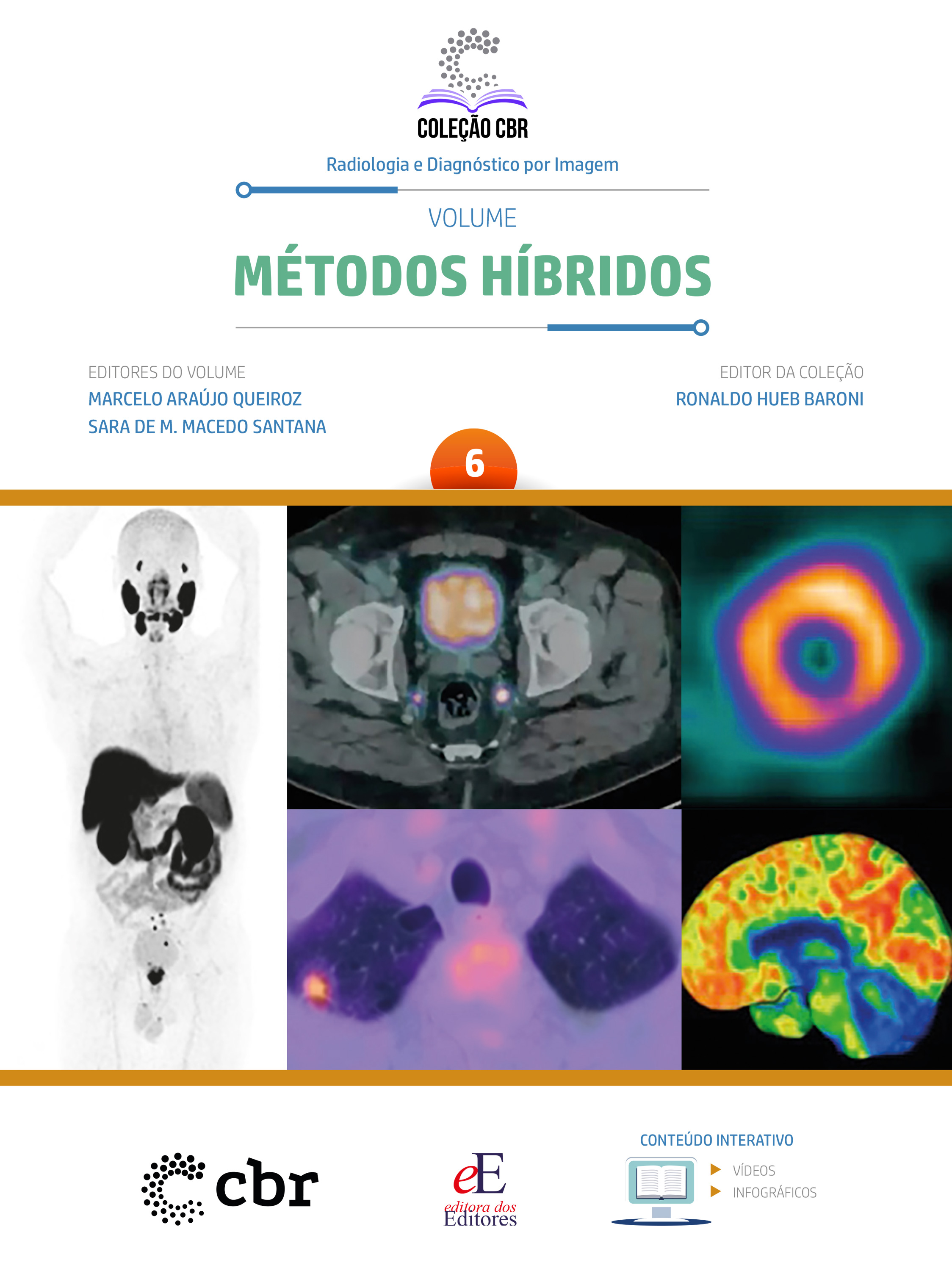 Coleção CBR Volume 6 - Métodos Híbridos