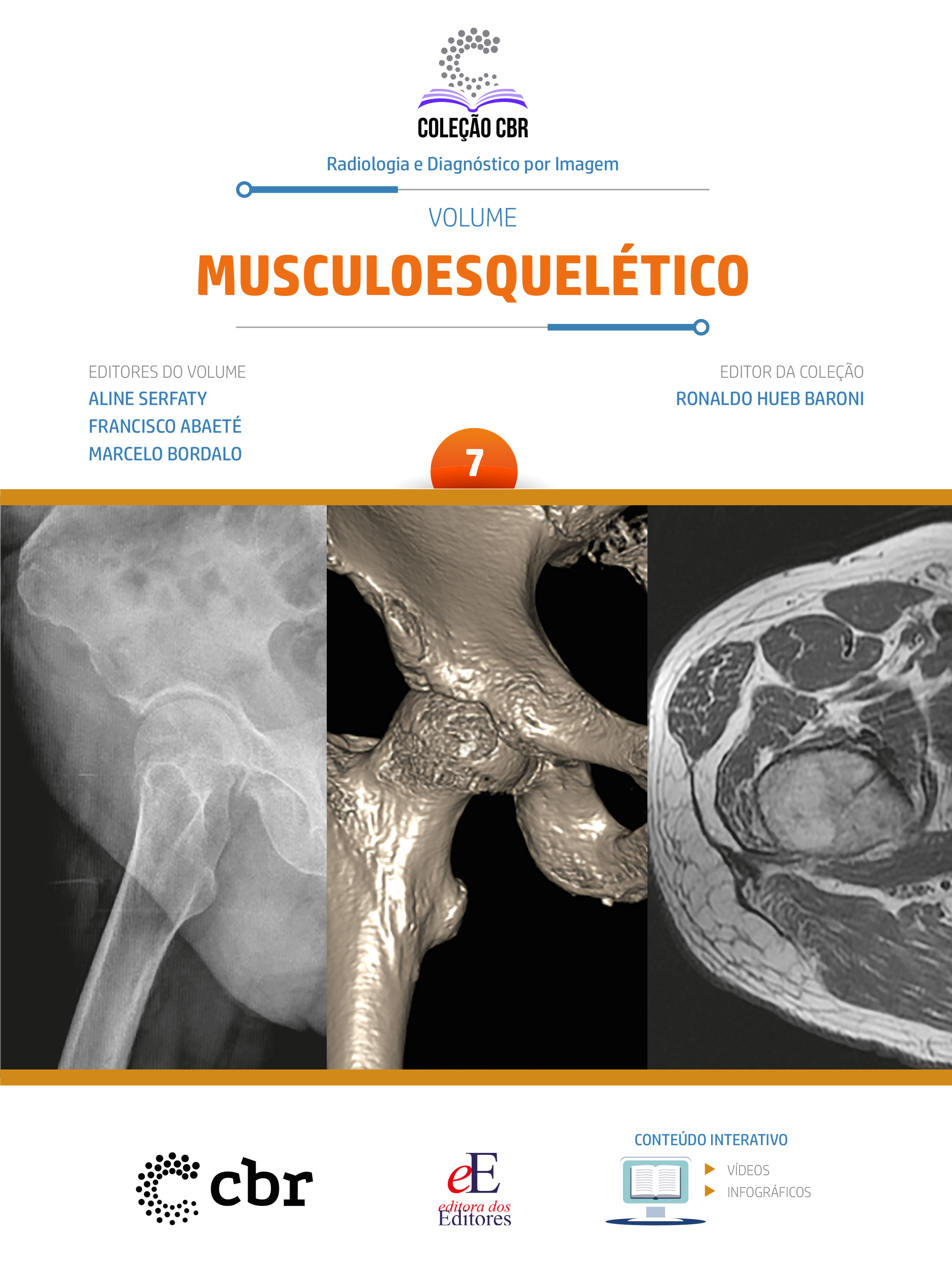 Coleção CBR Volume 7 - Musculoesquelético