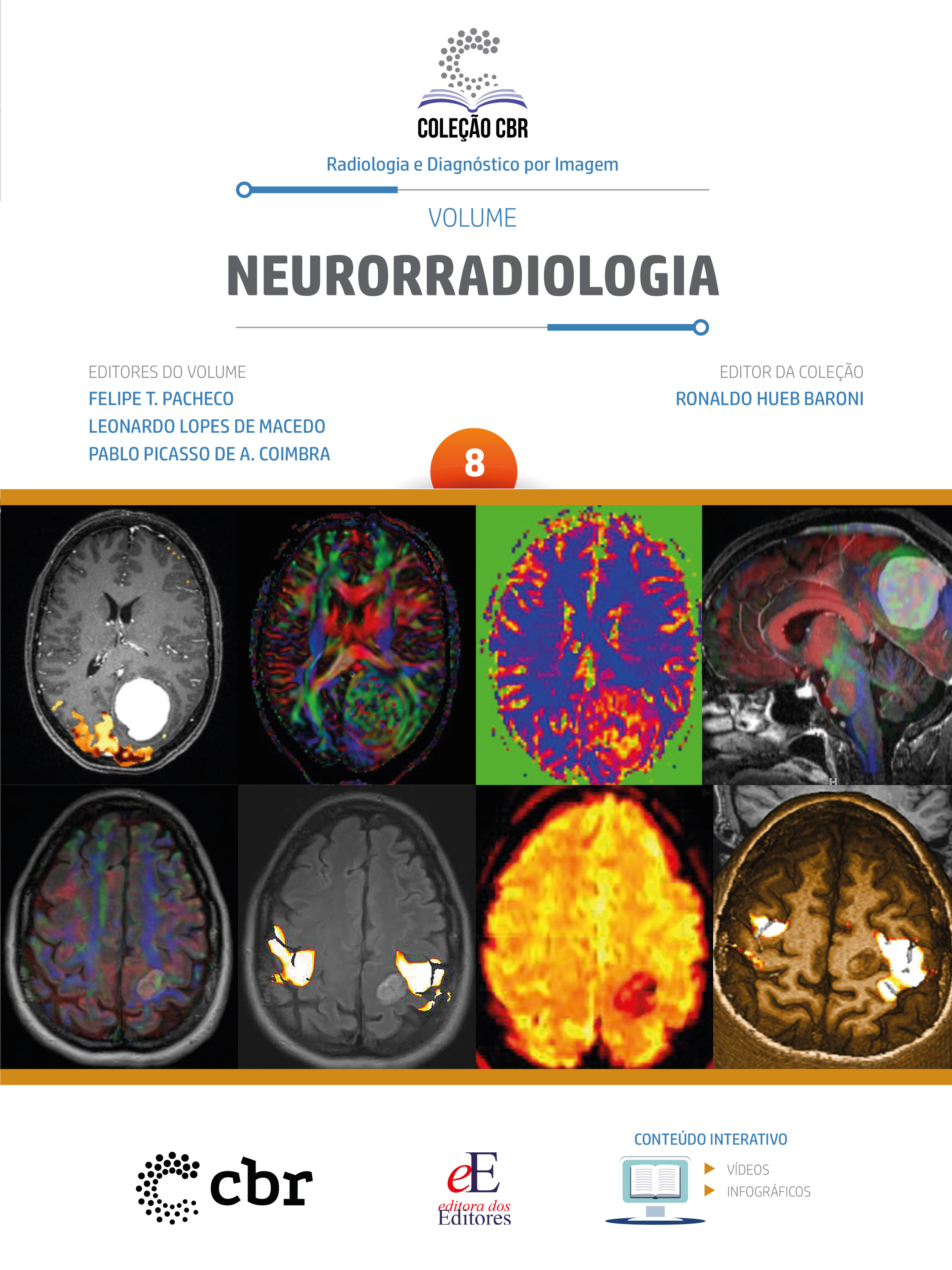 Coleção CBR Volume 8 - Neurorradiologia