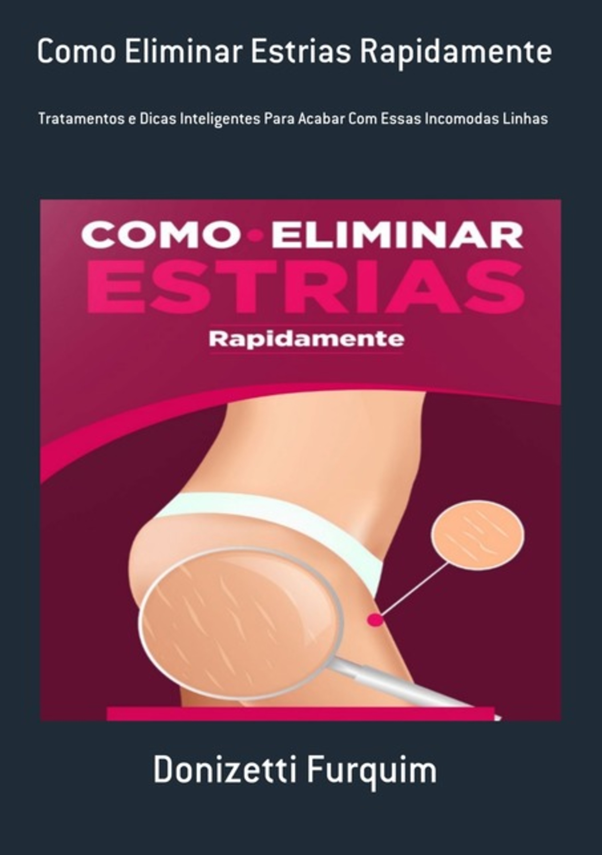 Como Eliminar Estrias Rapidamente