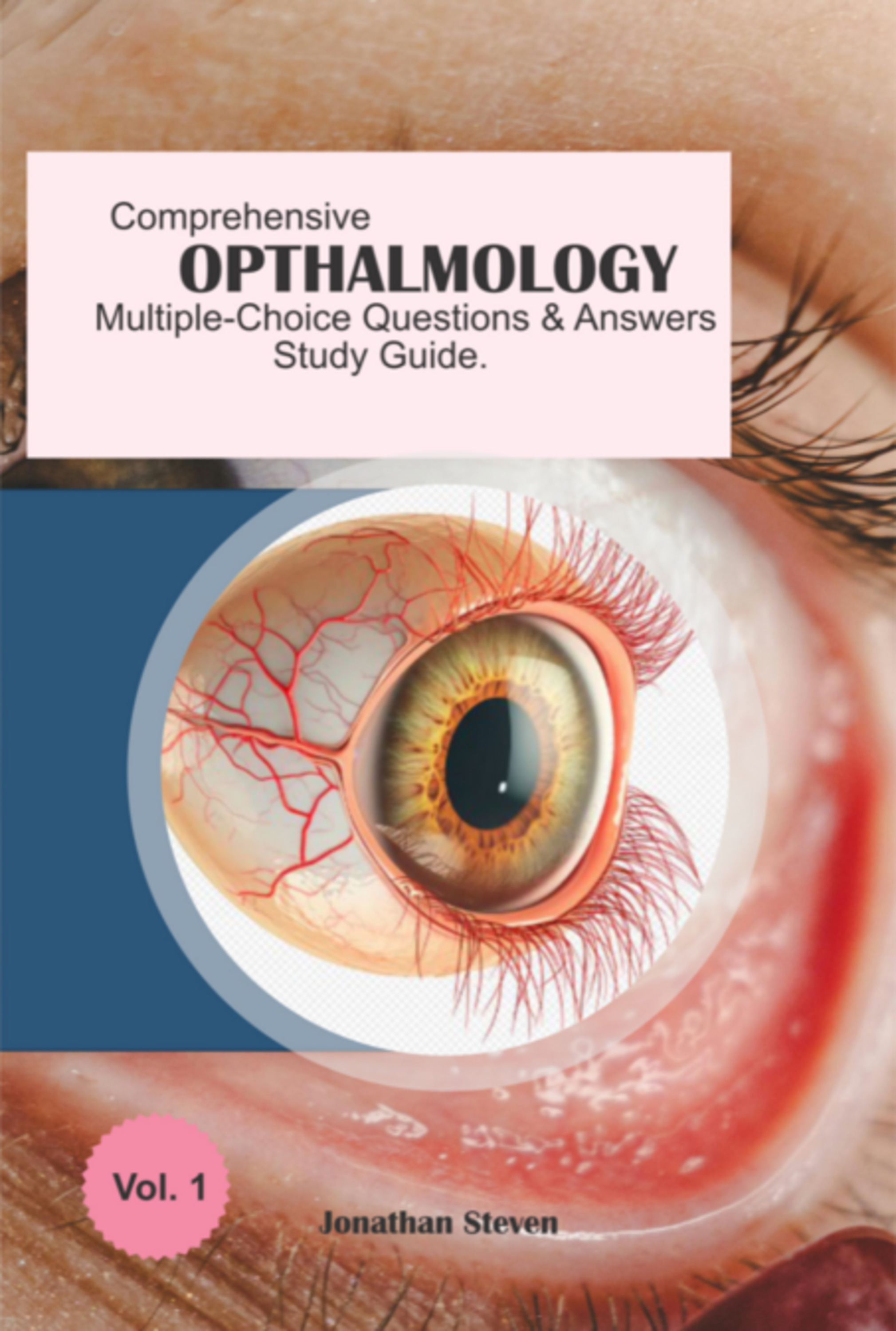 Comprehensive Ophthalmology Multiple-choice Questions And Answers Study Guide