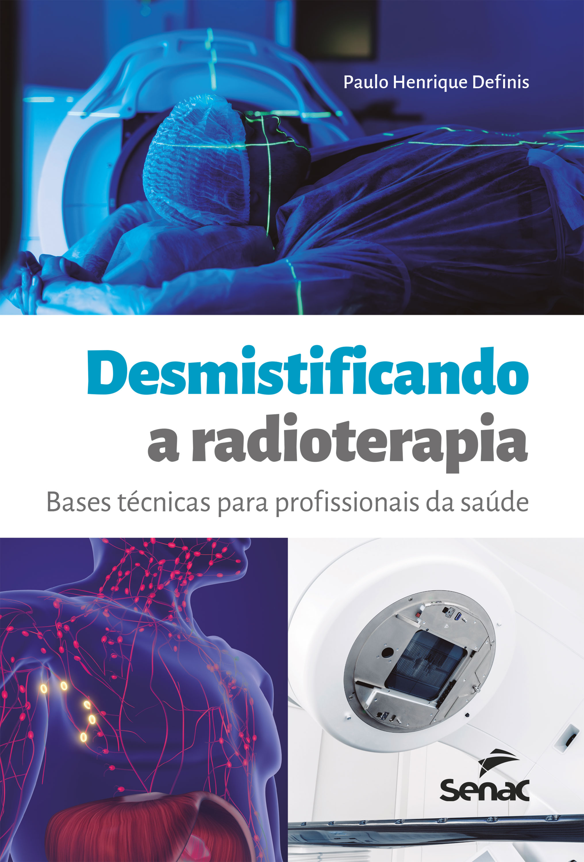 Desmistificando a radioterapia