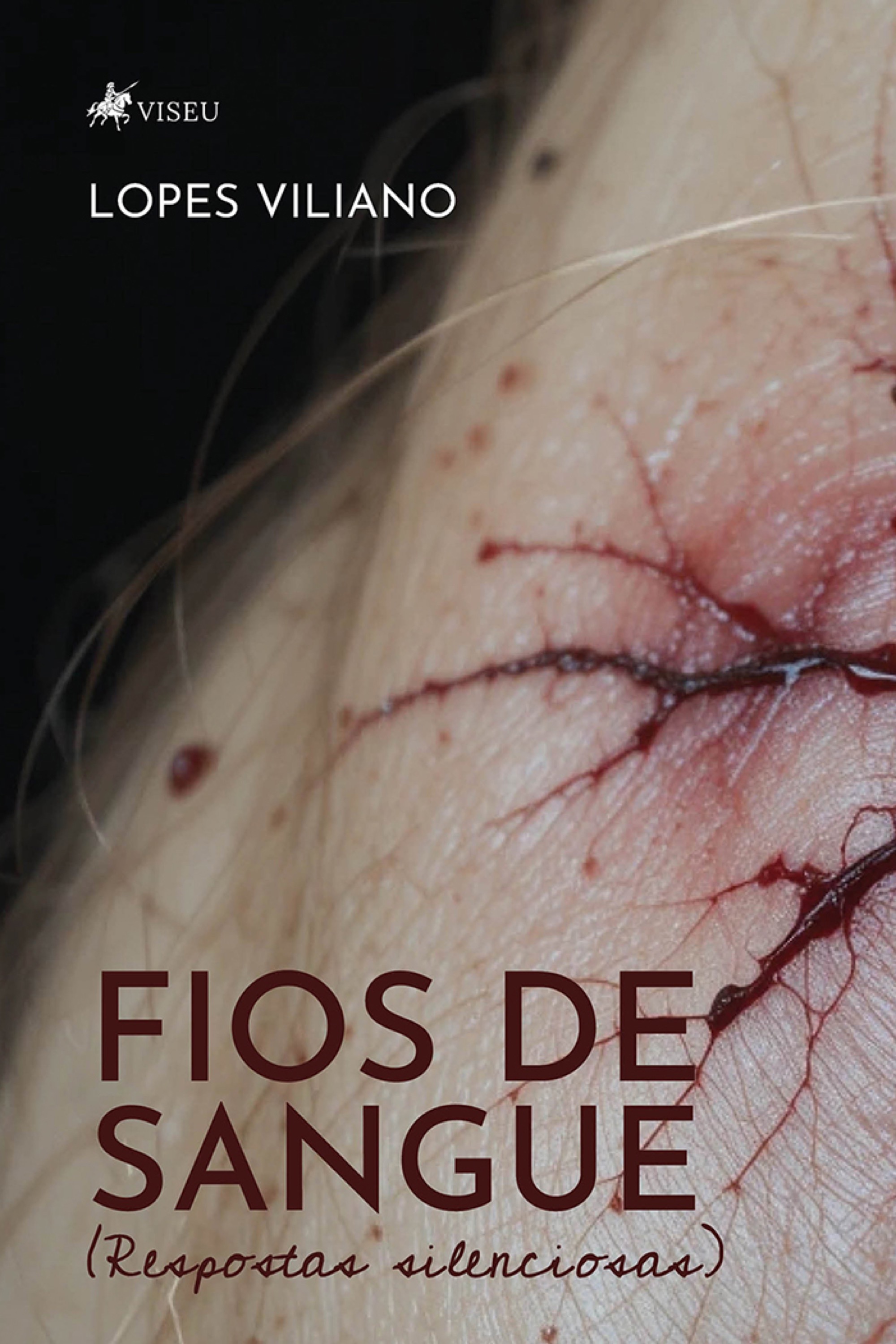 Fios de Sangue