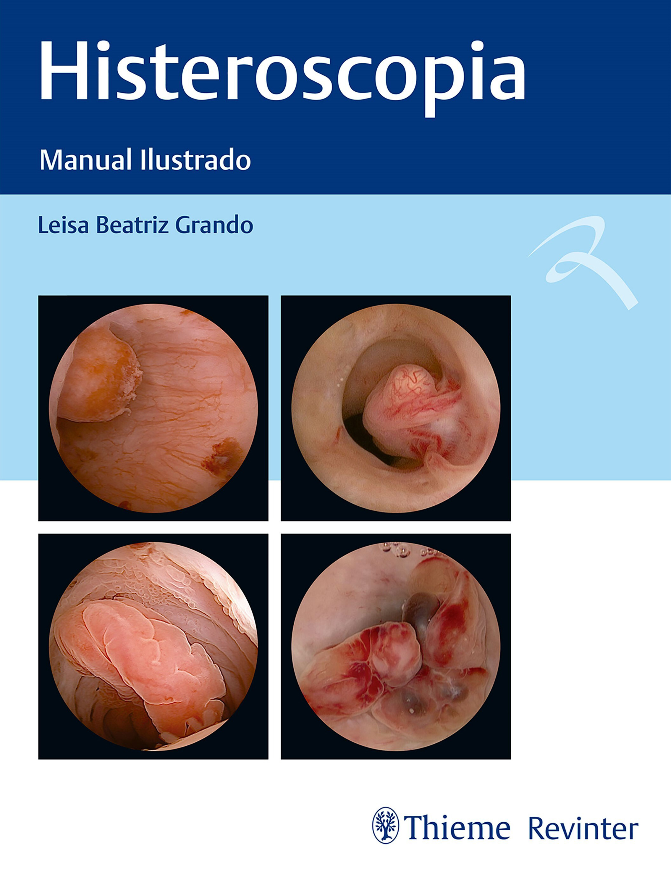 Histeroscopia