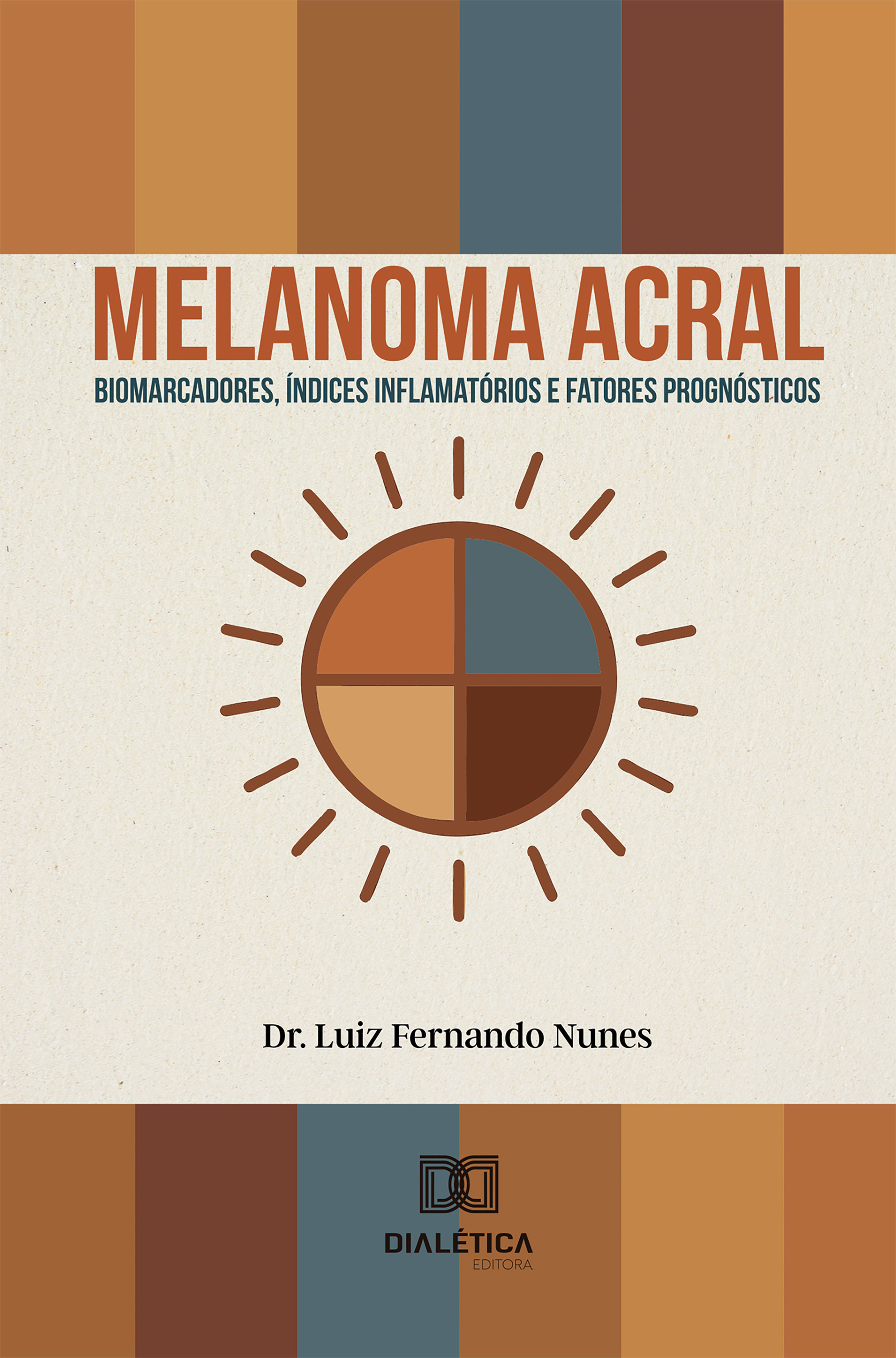 Melanoma acral