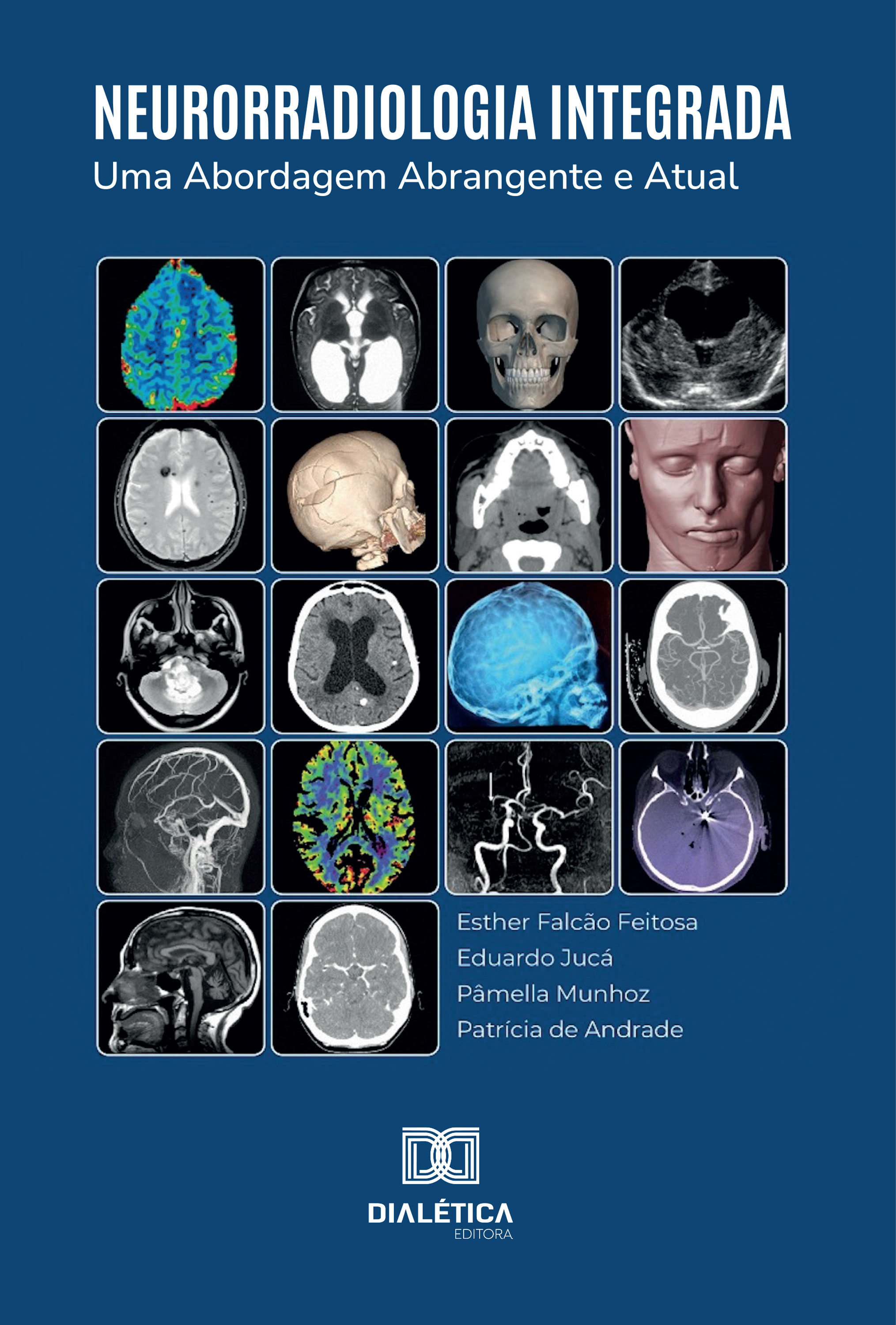 Neurorradiologia Integrada