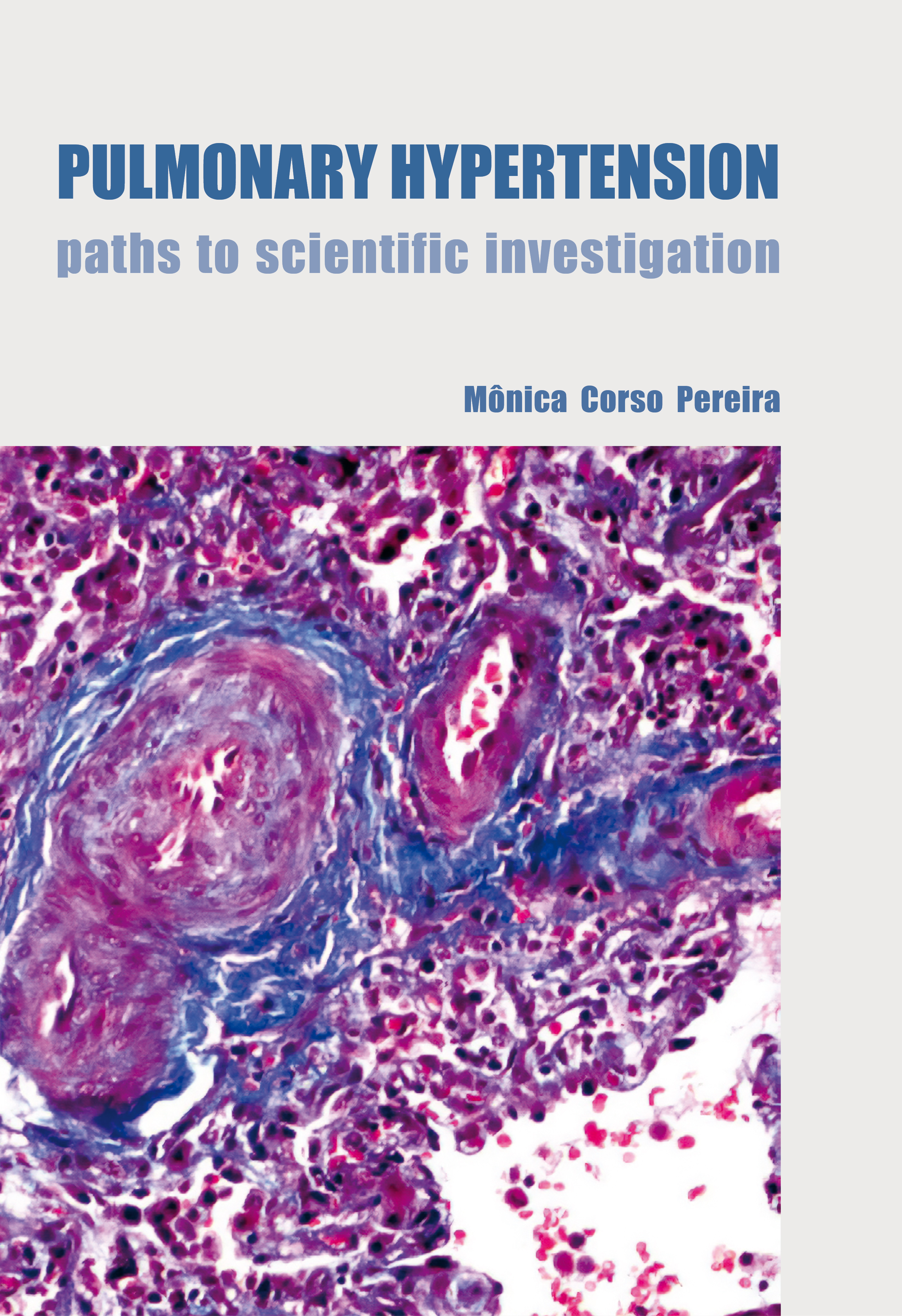 PULMONARY HYPERTENSION