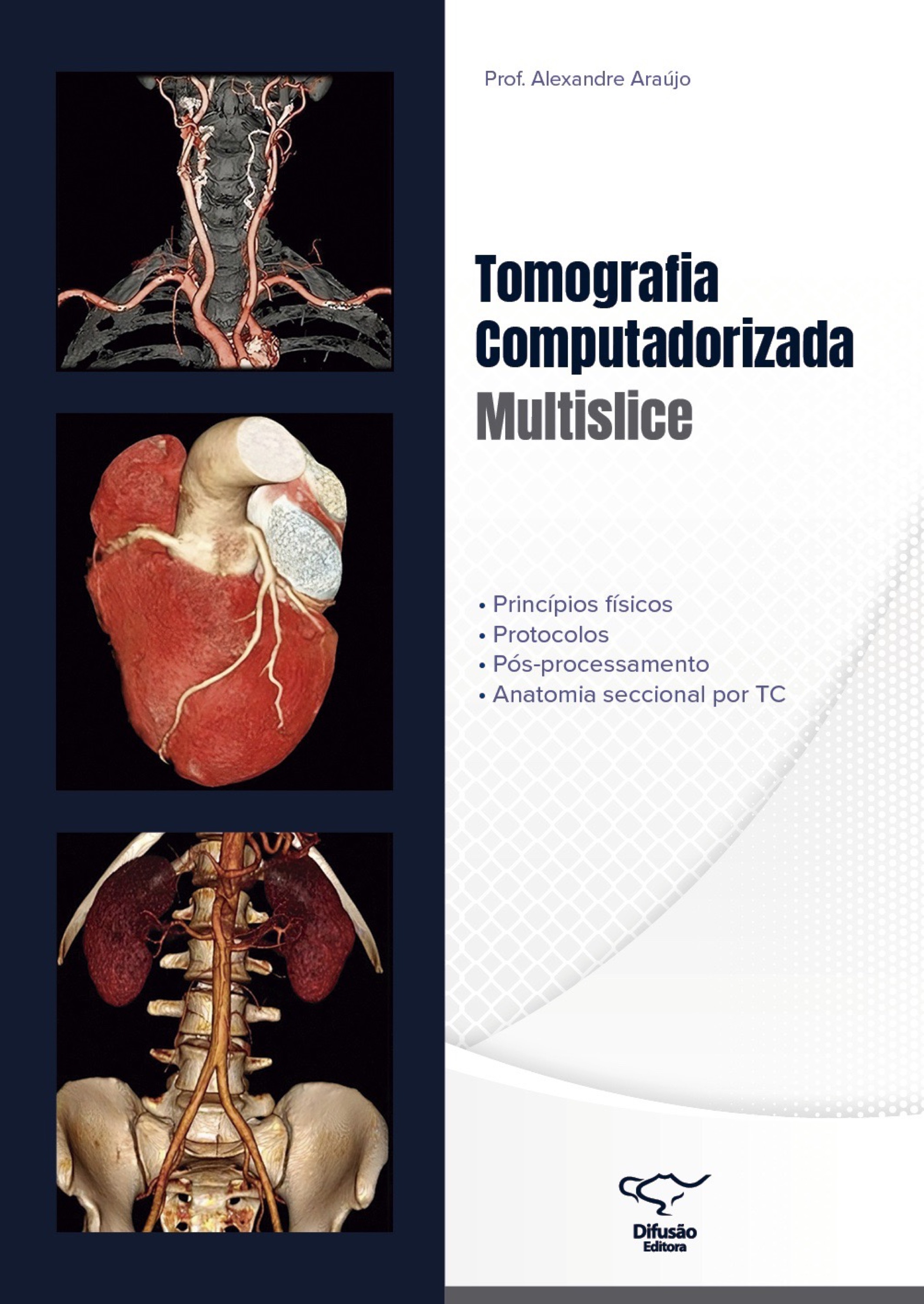 Tomografia Computadorizada Multislice