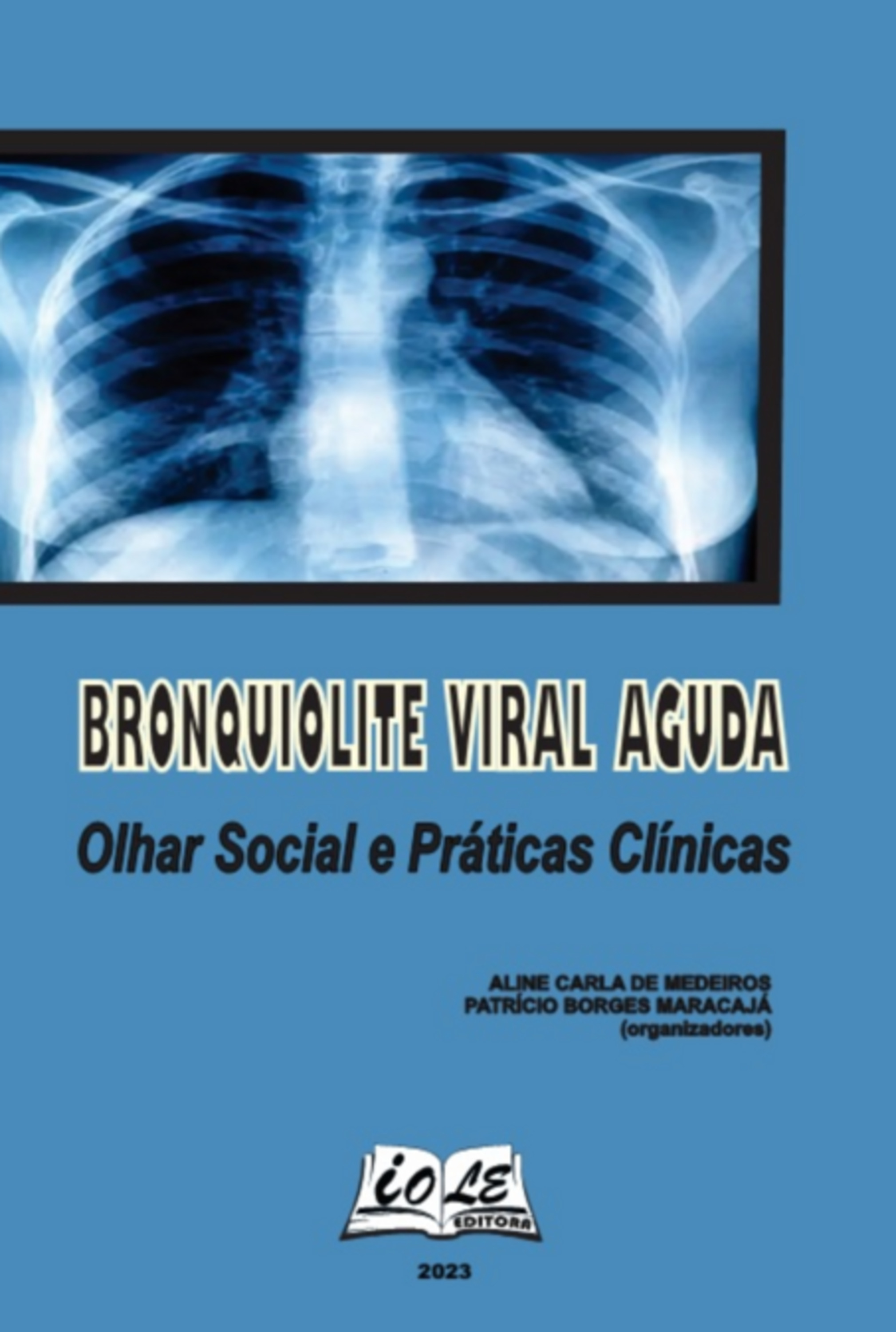 Bronquiolite Viral Aguda: Olhar Social E Práticas Clínicas