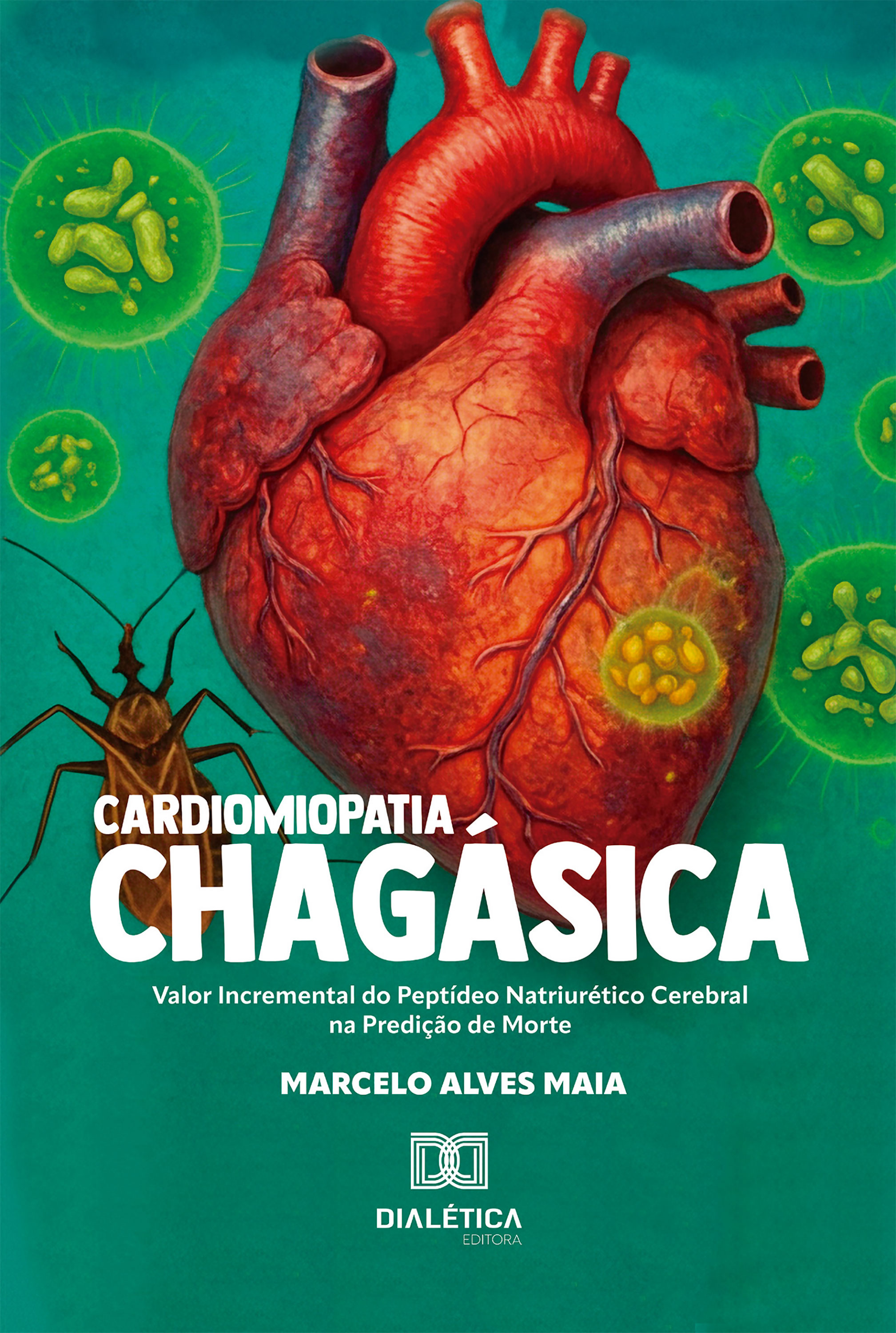 Cardiomiopatia Chagásica