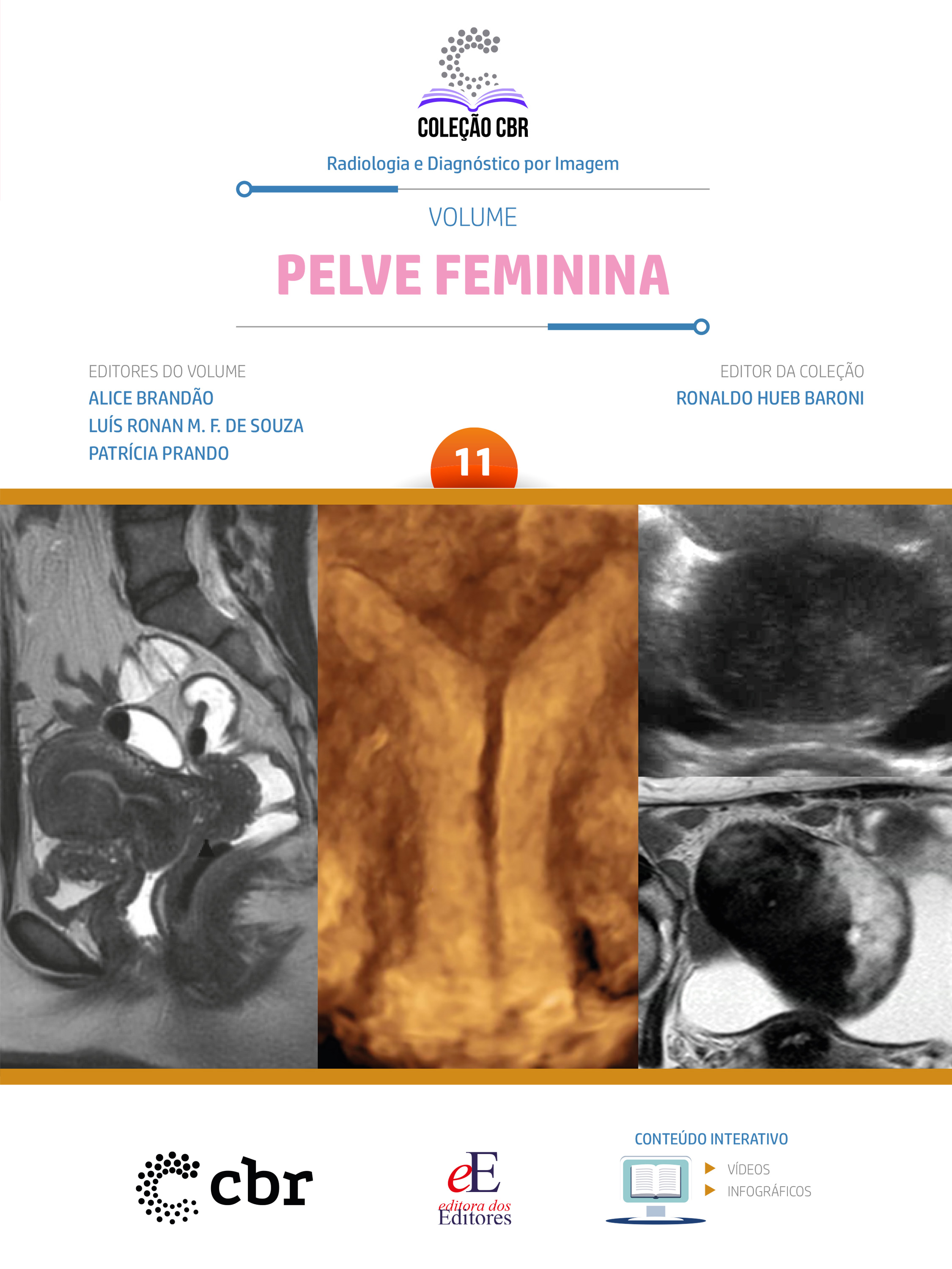 Coleção CBR Volume 11 Pelve Feminina