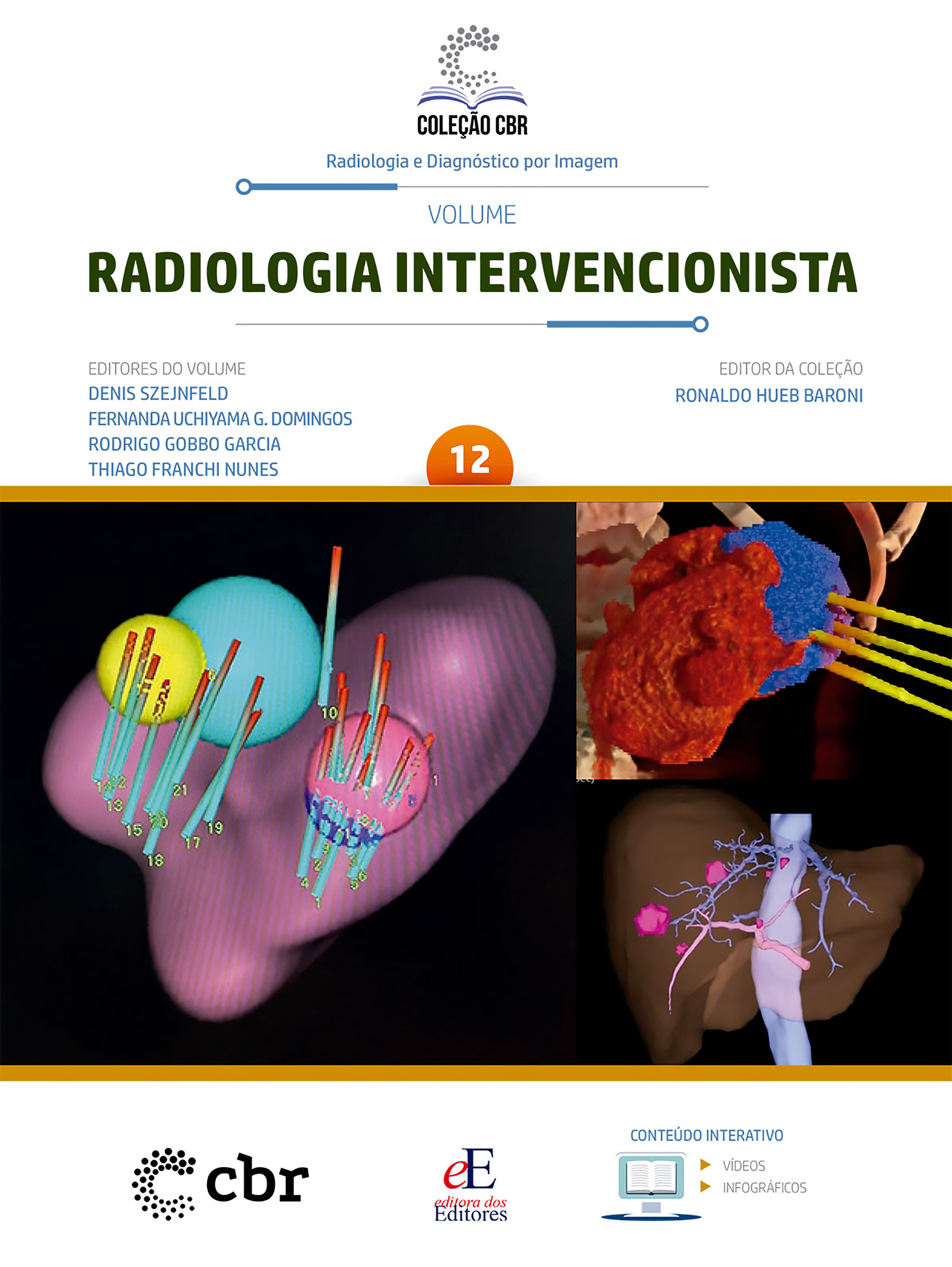 Coleção CBR Volume 12 - Radiologia Intervencionista
