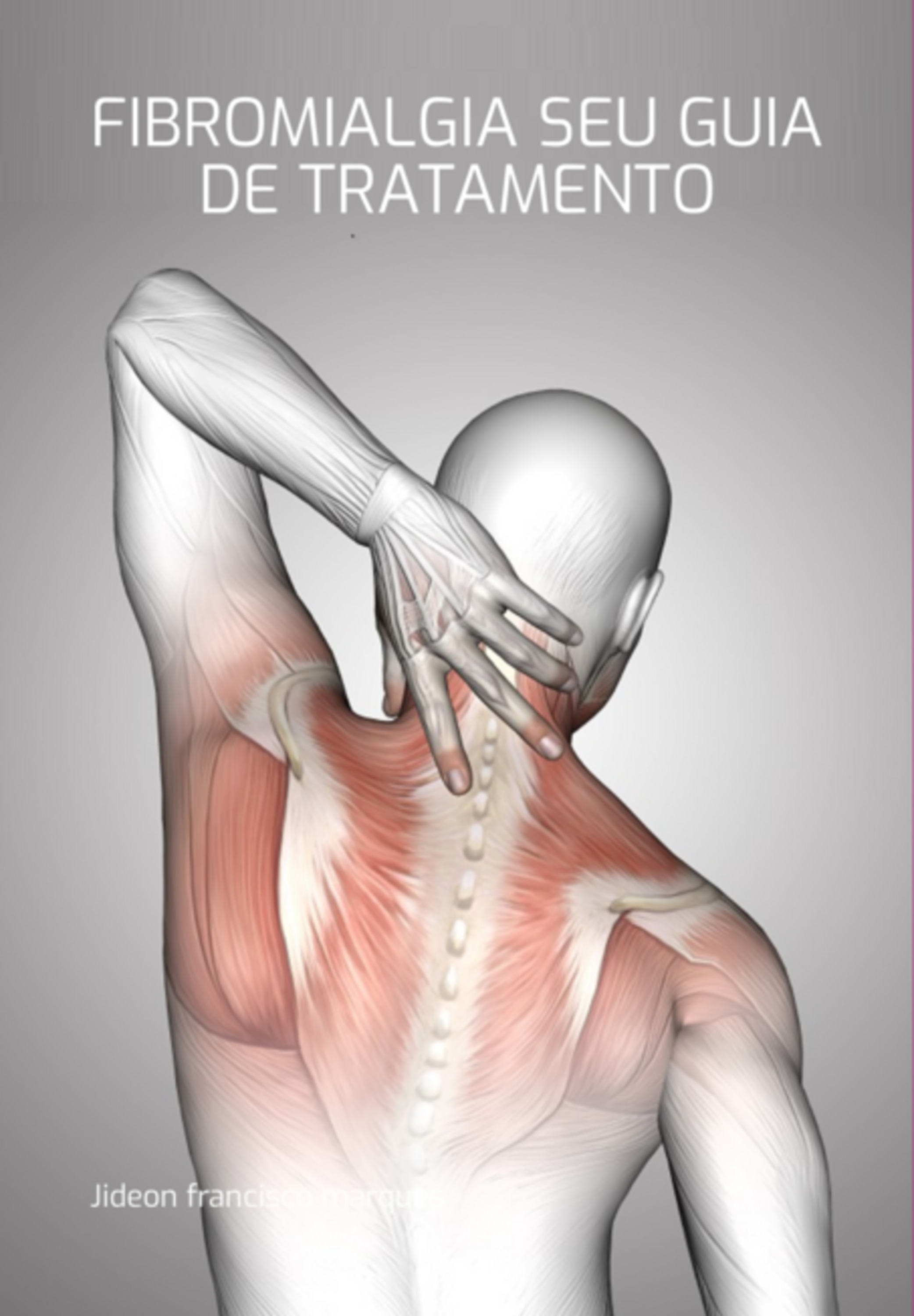 Fibromialgia Seu Guia De Tratamento