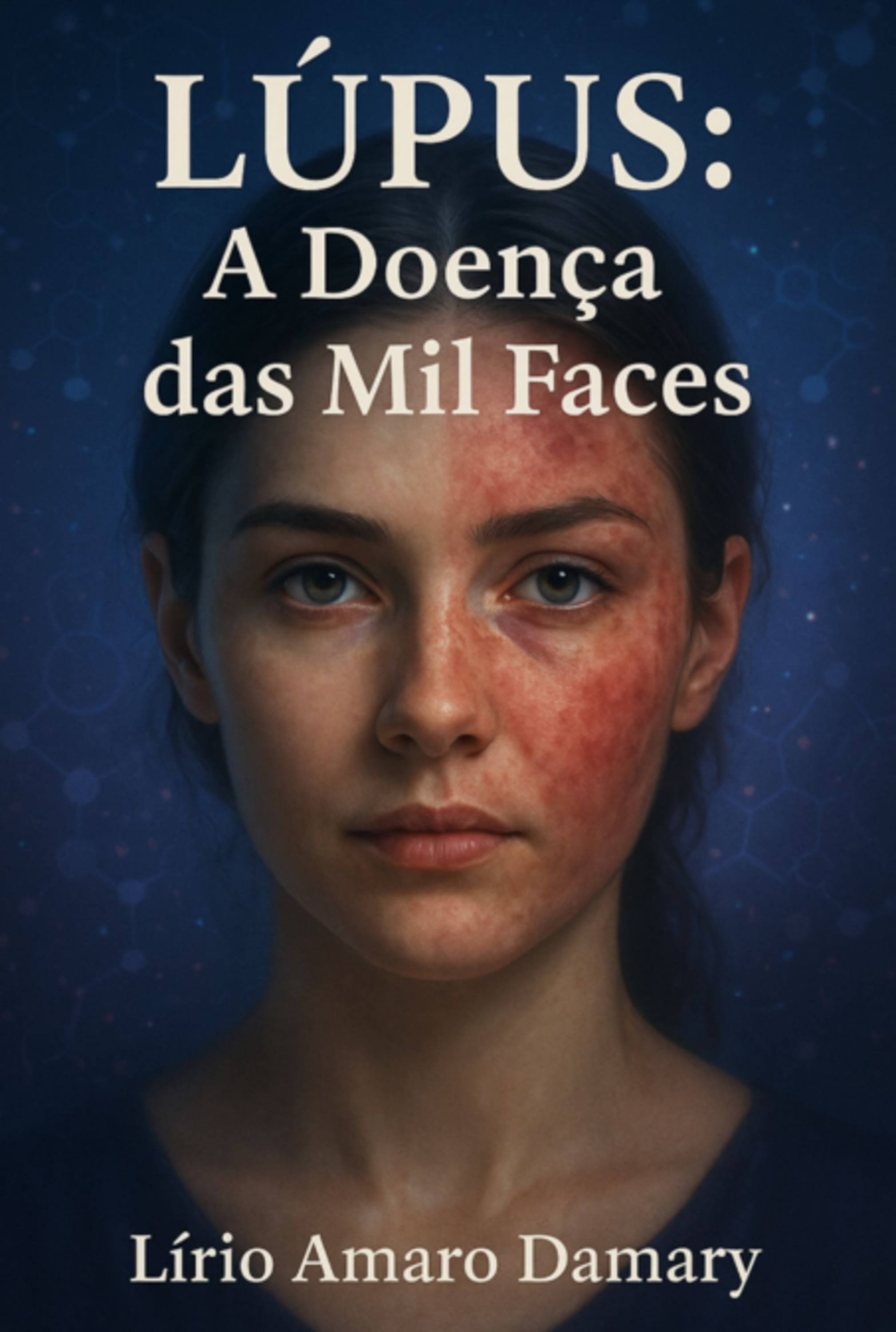 Lúpus: A Doença Das Mil Faces