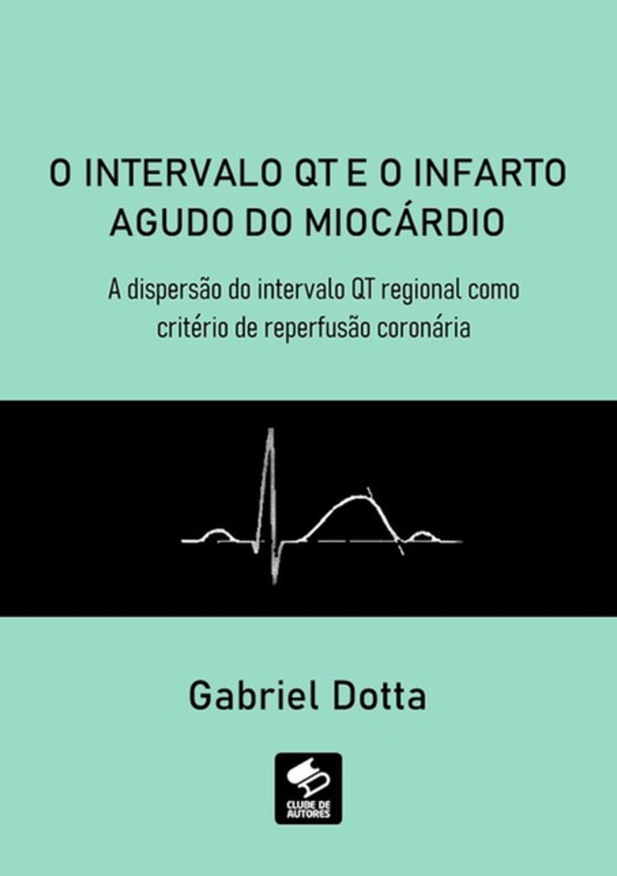 O Intervalo Qt E O Infarto Agudo Do Miocárdio