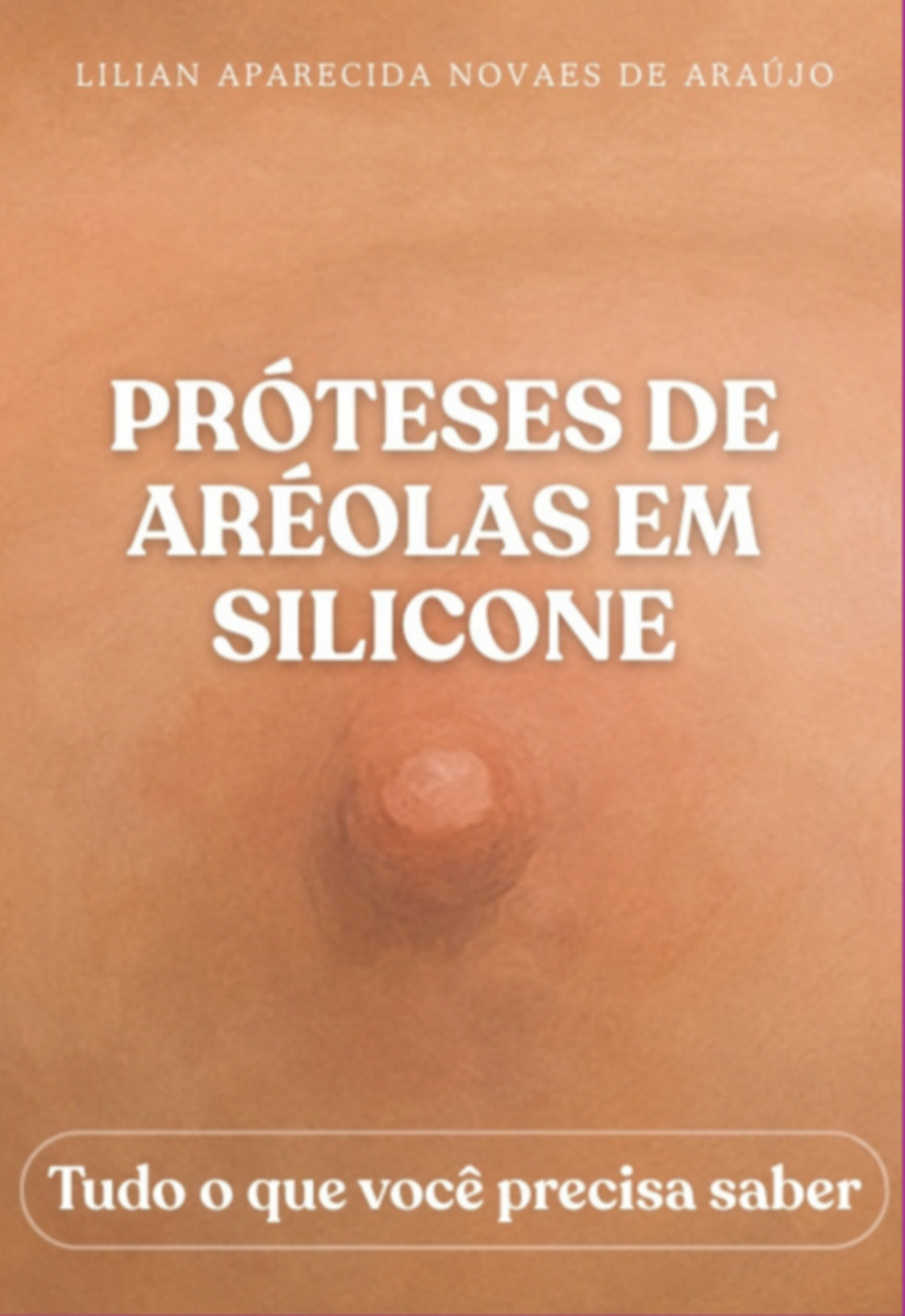 Próteses De Aréolas Em Silicone