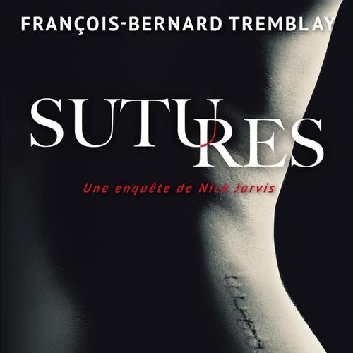 Sutures