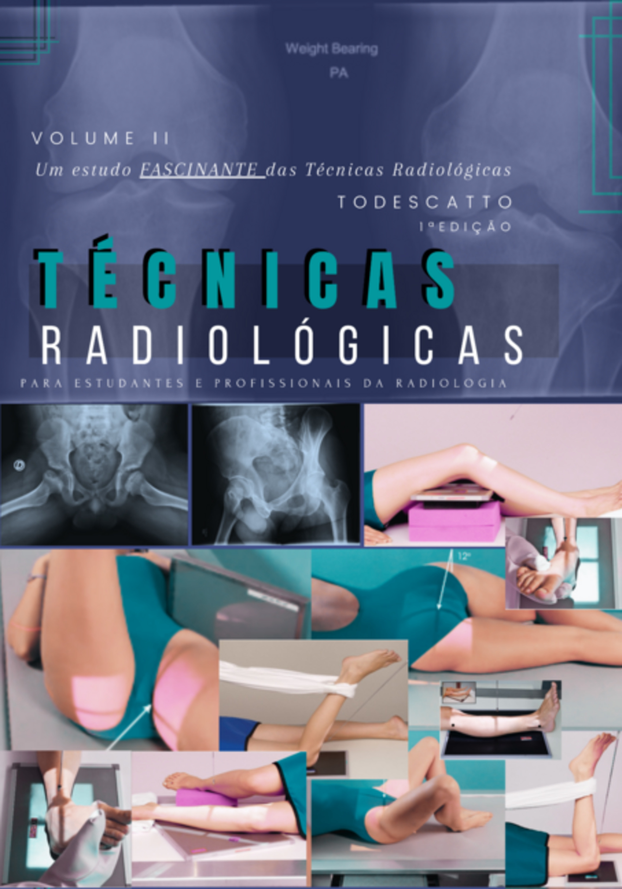 Técnicas Radiológicas Volume Ii