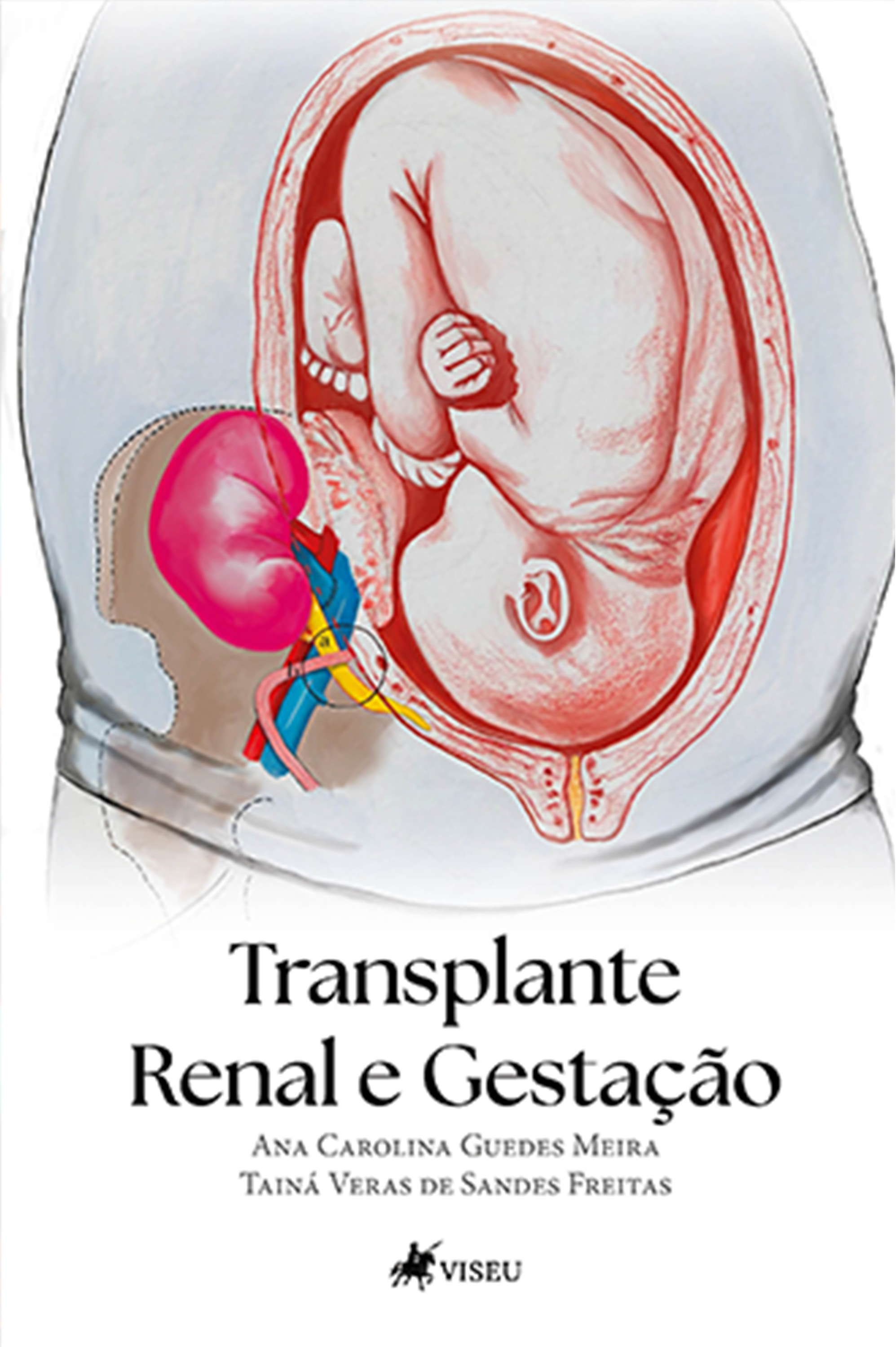 Transplante Renal e Gestação