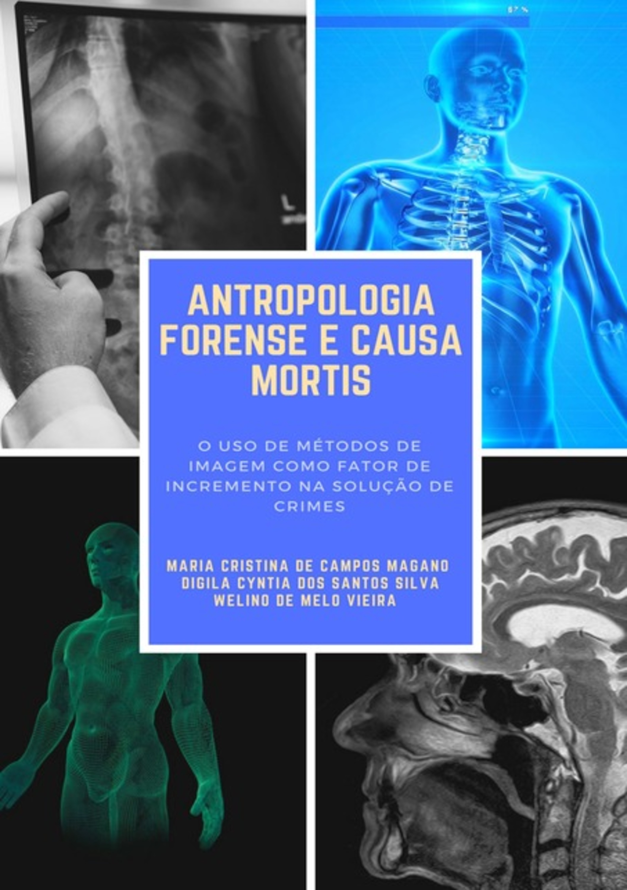 Antropologia Forense E Causa Mortis