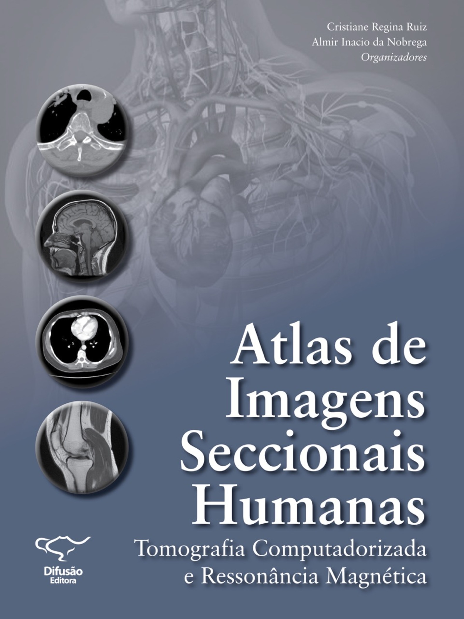 Atlas de Imagens Seccionais Humanas: Tomografia Computadorizada e Ressonância Magnética