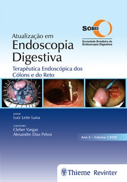 Atualização em Endoscopia Digestiva