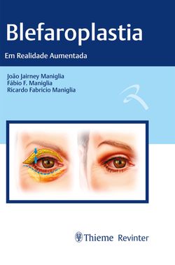 Blefaroplastia