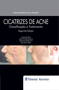 Cicatrizes de Acne