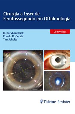 Cirurgia a Laser de Femtossegundo em Oftalmologia