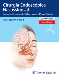 Cirurgia Endoscópica Nasossinusal