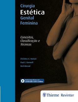 Cirurgia estética genital feminina