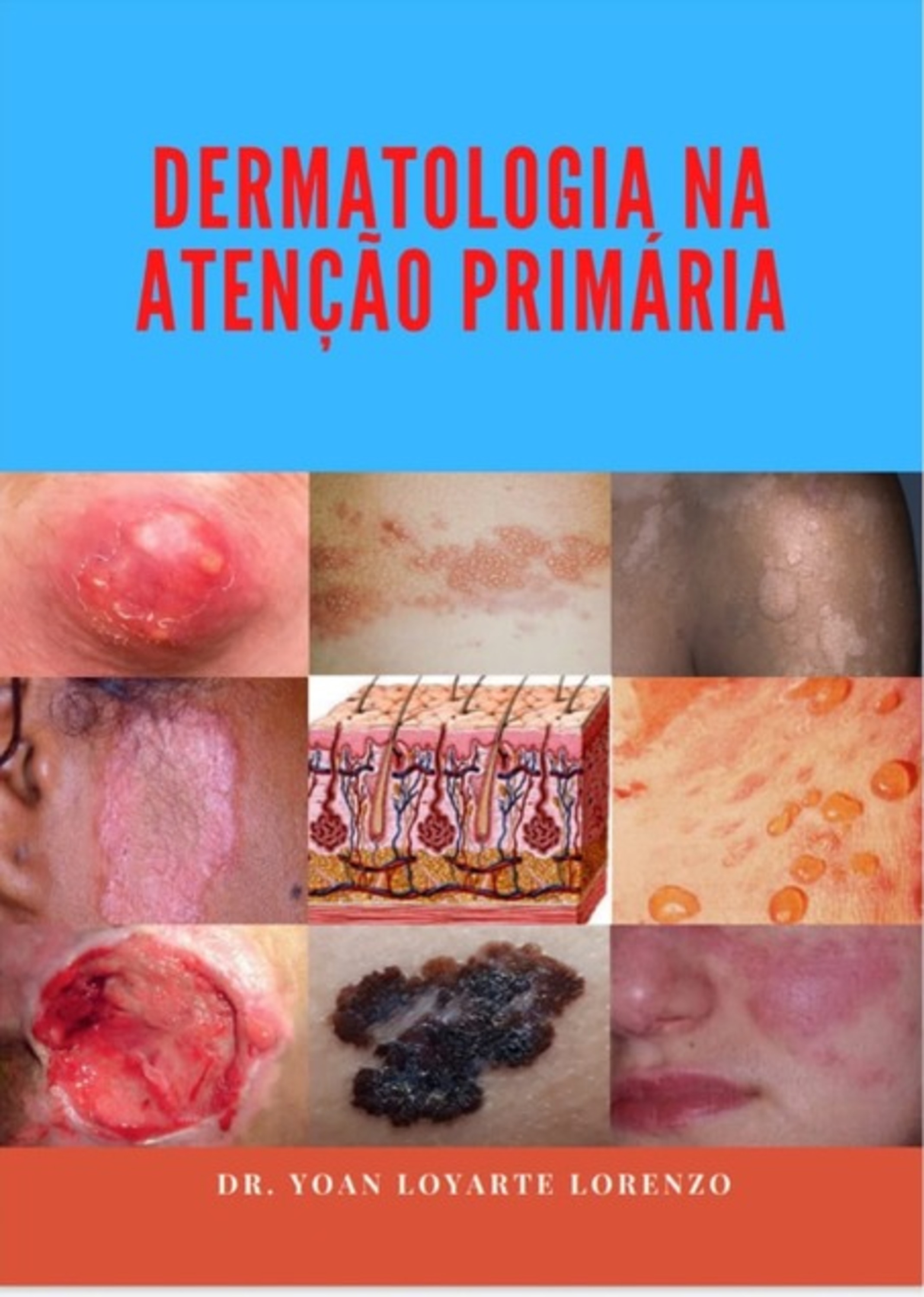 Dermatologia Na Atenção Primária