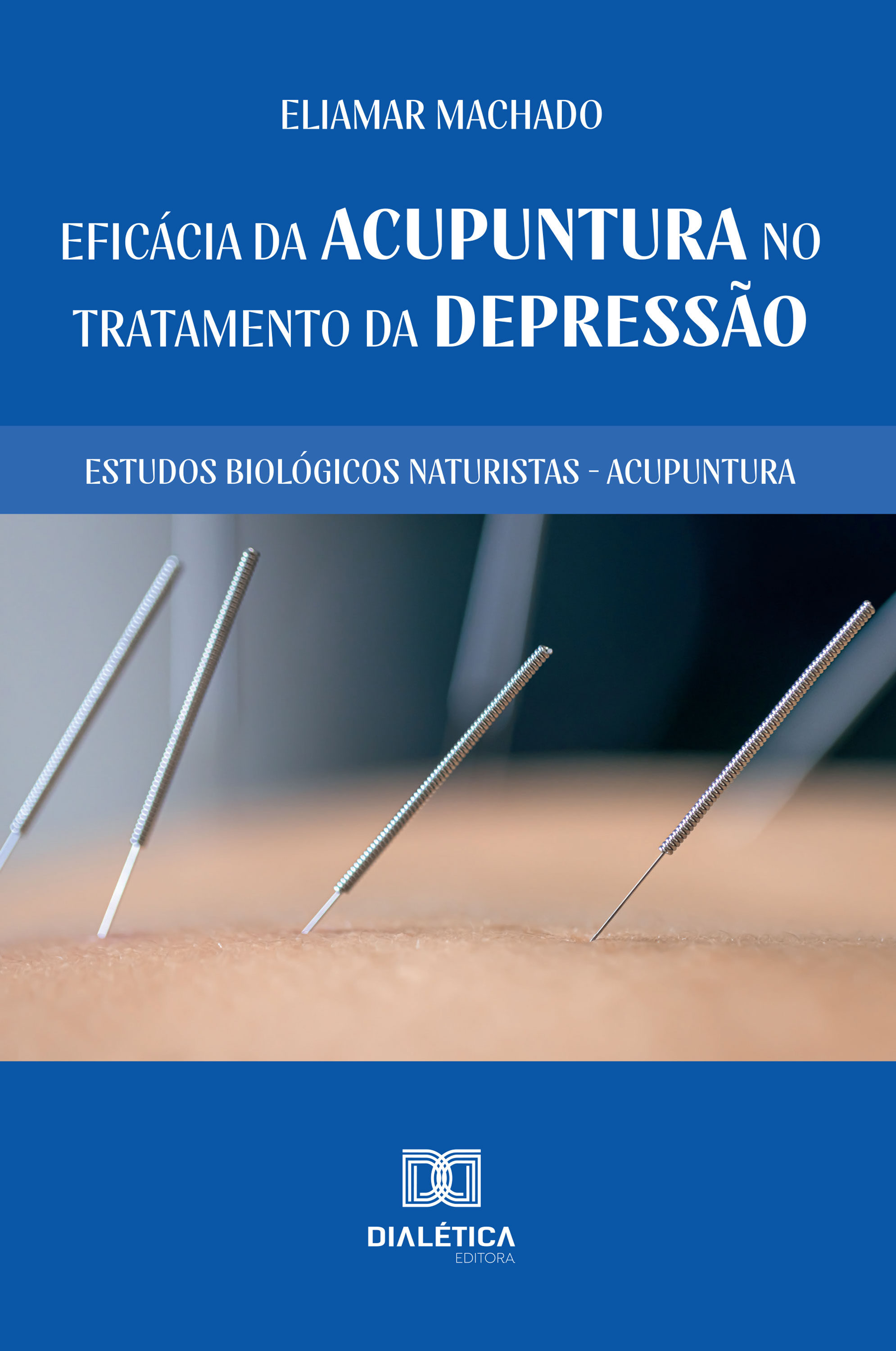 Eficácia da Acupuntura no Tratamento da Depressão