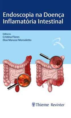 Endoscopia na Doença Inflamatória Intestinal