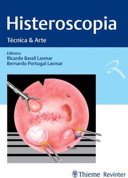 Histeroscopia