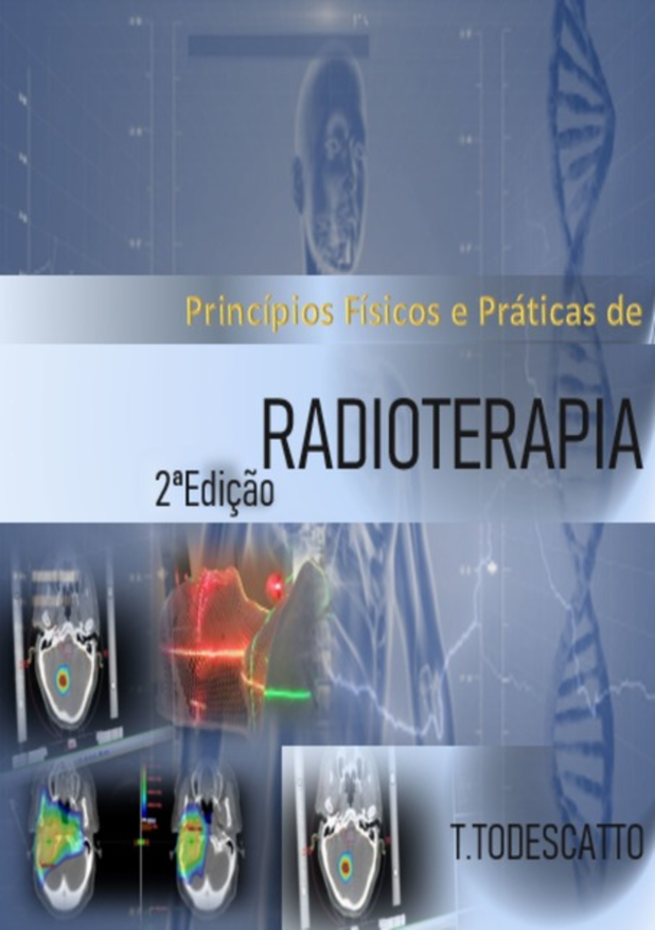 Radioterapia