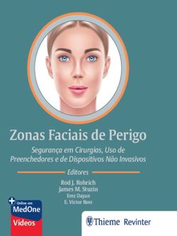 Zonas Faciais de Perigo