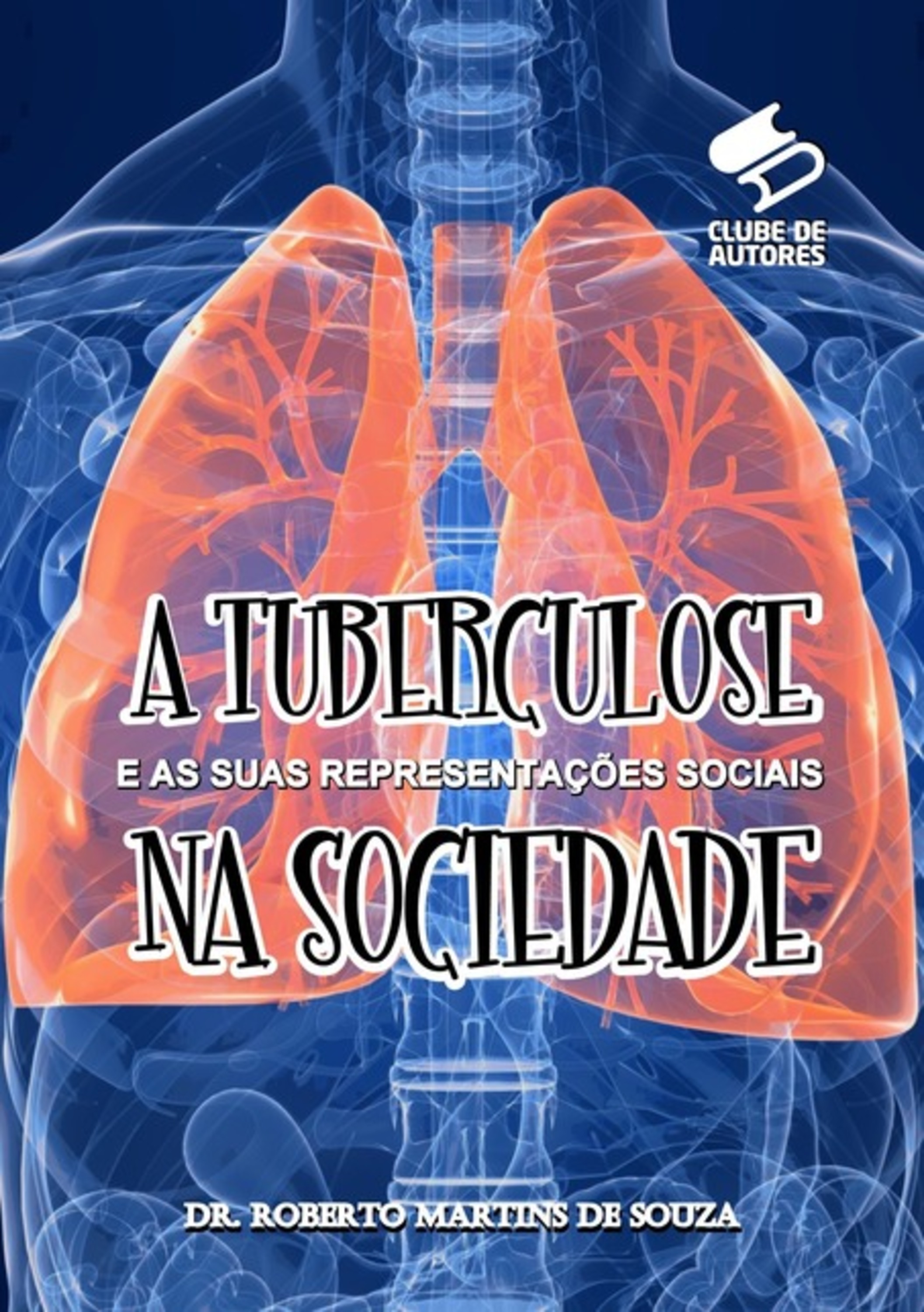 A Tuberculose E As Suas Representações Sociais Na Sociedade