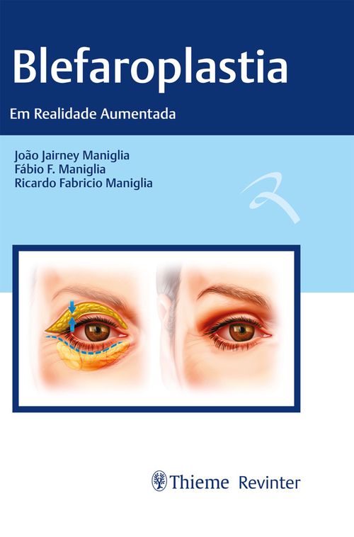 Blefaroplastia