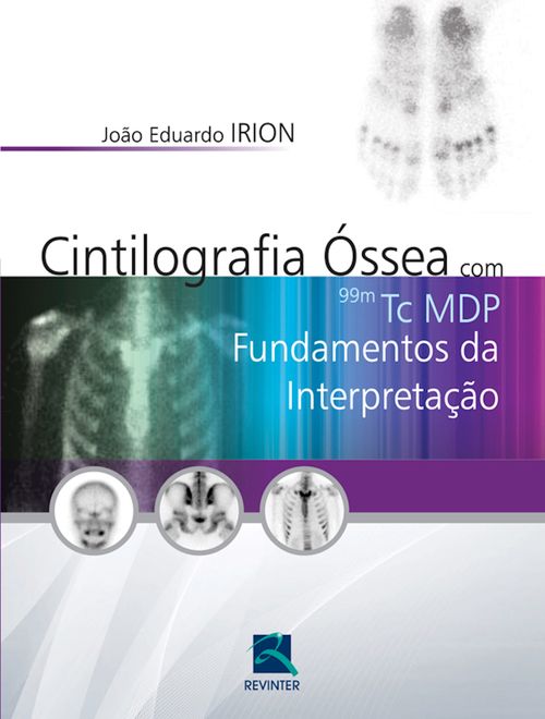 Cintilografia óssea com 99mTc MDP