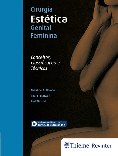 Cirurgia estética genital feminina