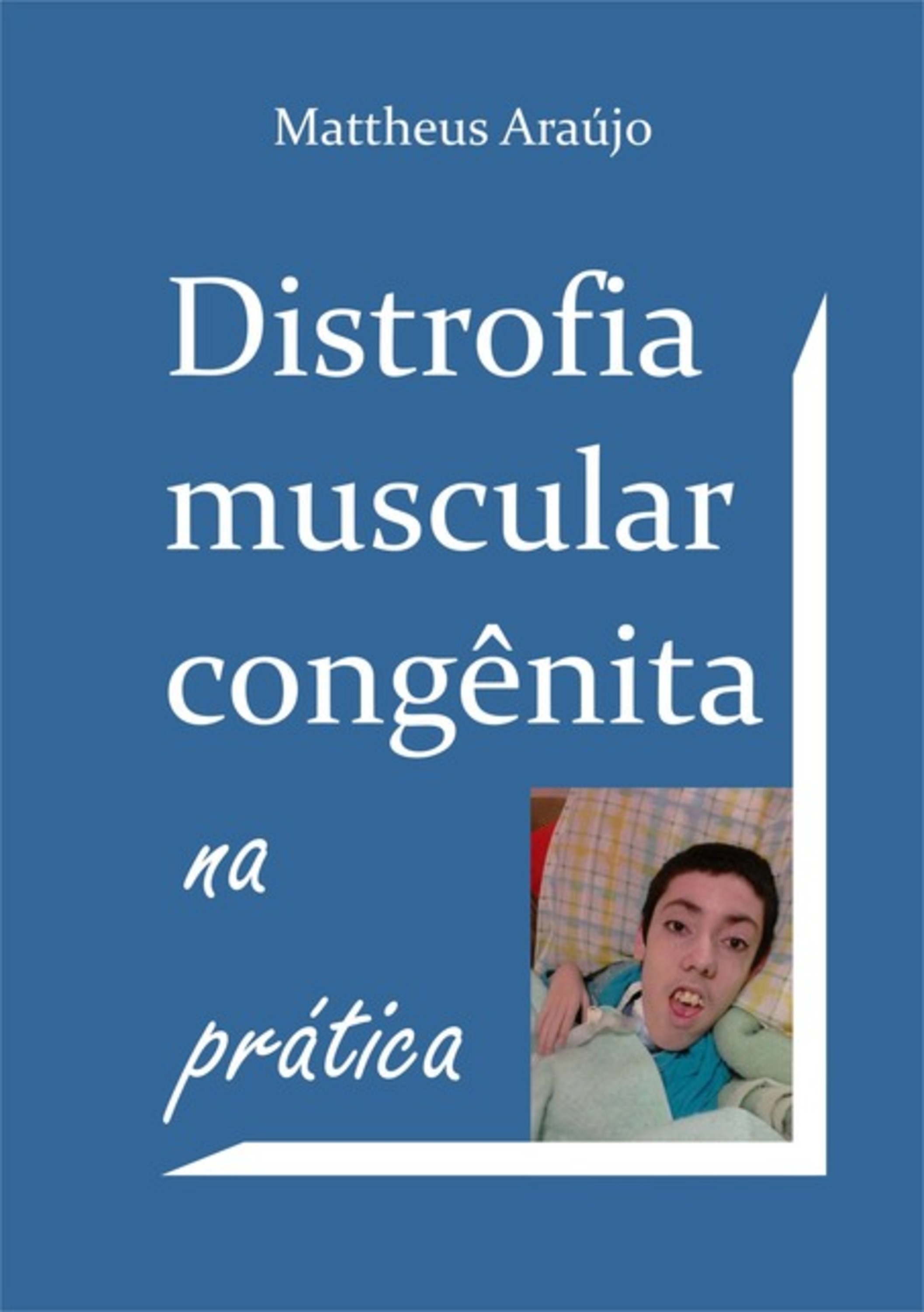 Distrofia Muscular Congênita Na Prática