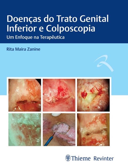 Doenças do Trato Genital Inferior e Colposcopia