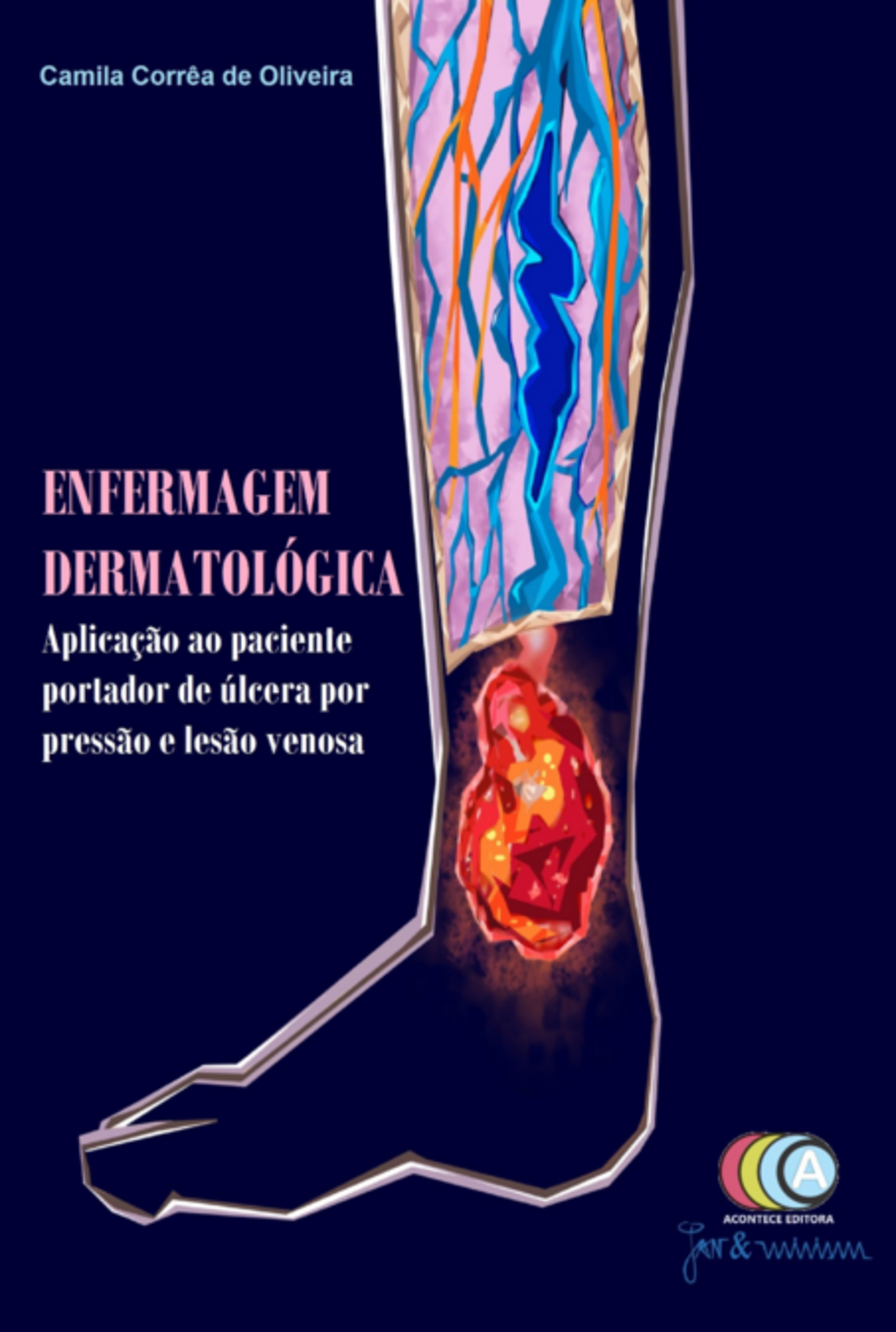 Enfermagem Dermatológica