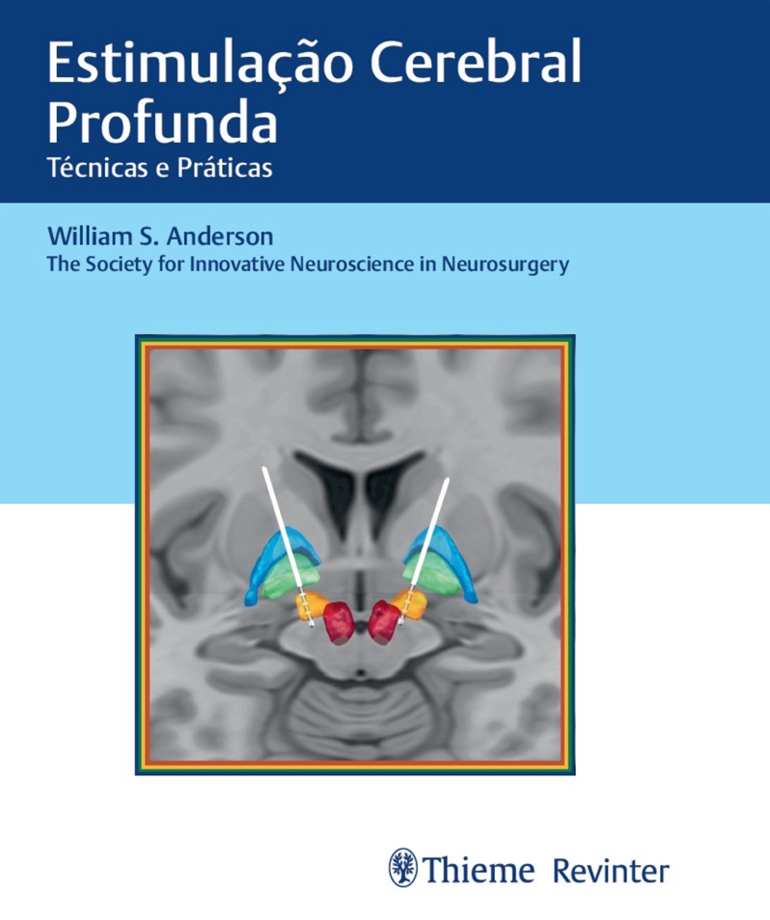 Estimulação Cerebral Profunda